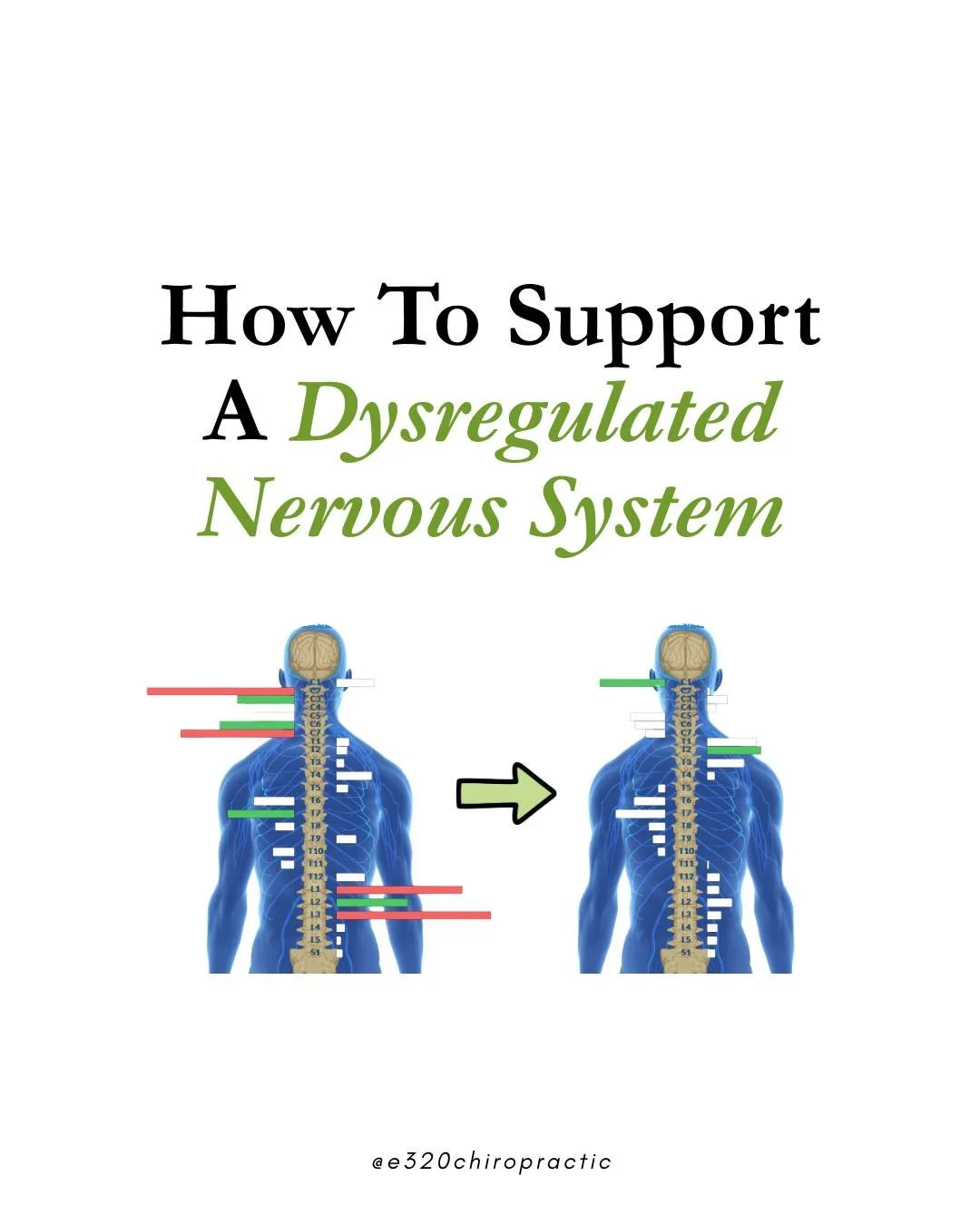 Head to the link in our bio to learn what can help support a dysregulated nervous system and schedule neurological scans at E320 Chiropractic! 💚

#e320chiropractic #pxdocs #andersonsc #pediatricchiropractic