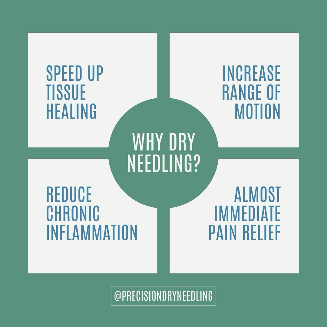 Dry needling goes well beyond just this. Message us today to see if dry needling could be right for you!