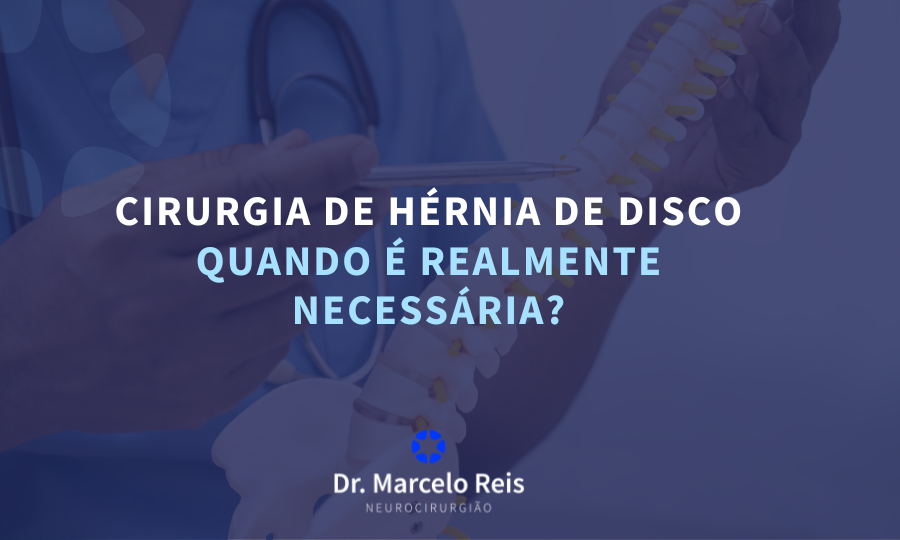 Cirurgia de Hérnia de Disco: Quando é Realmente Necessária?
