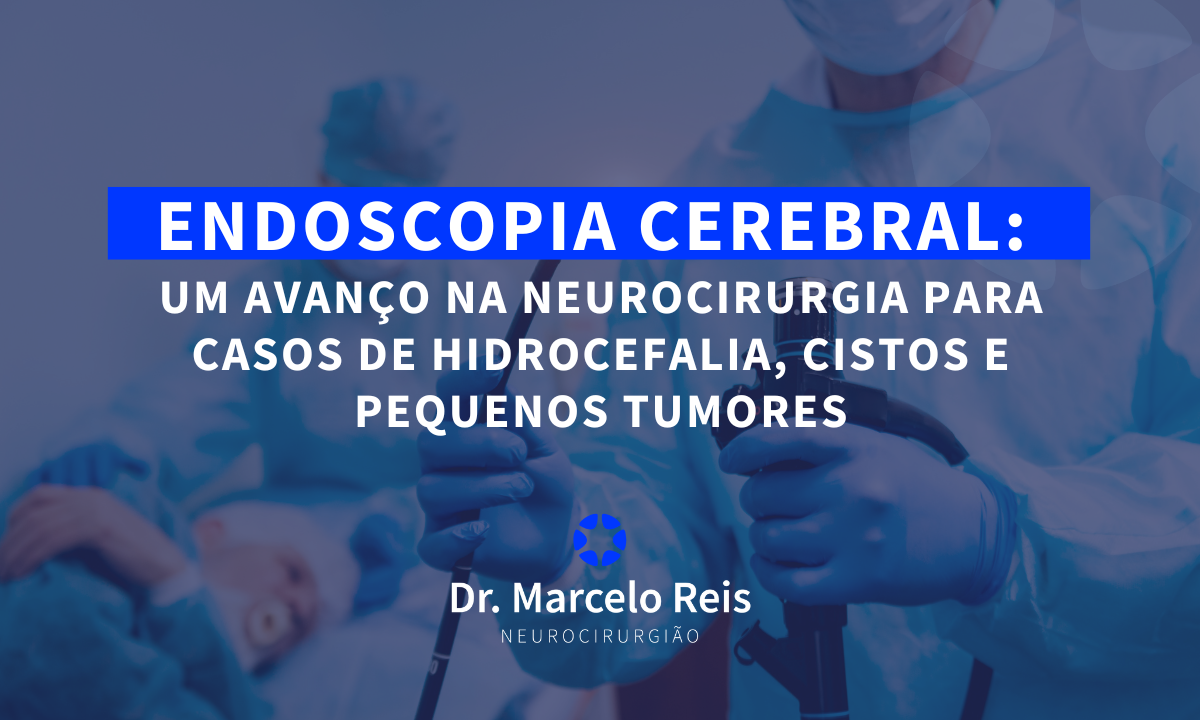 Endoscopia Cerebral: Um Avanço na Neurocirurgia para Casos de Hidrocefalia, Cistos e Pequenos Tumores
