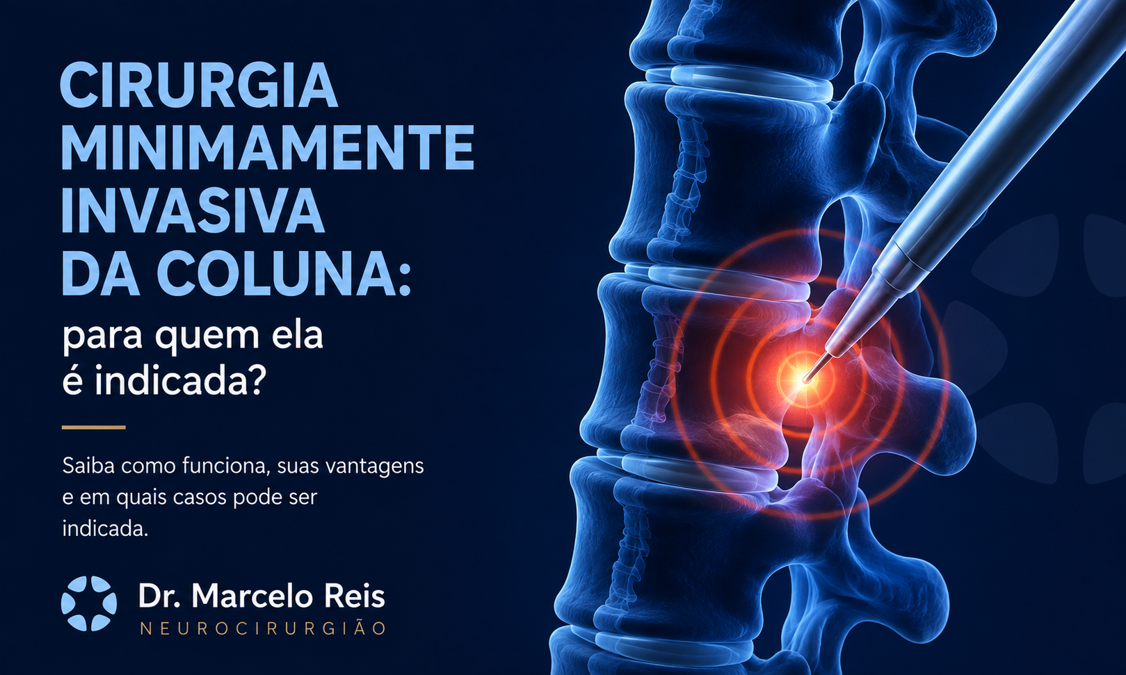 Cirurgia minimamente invasiva da coluna: para quem ela é indicada?