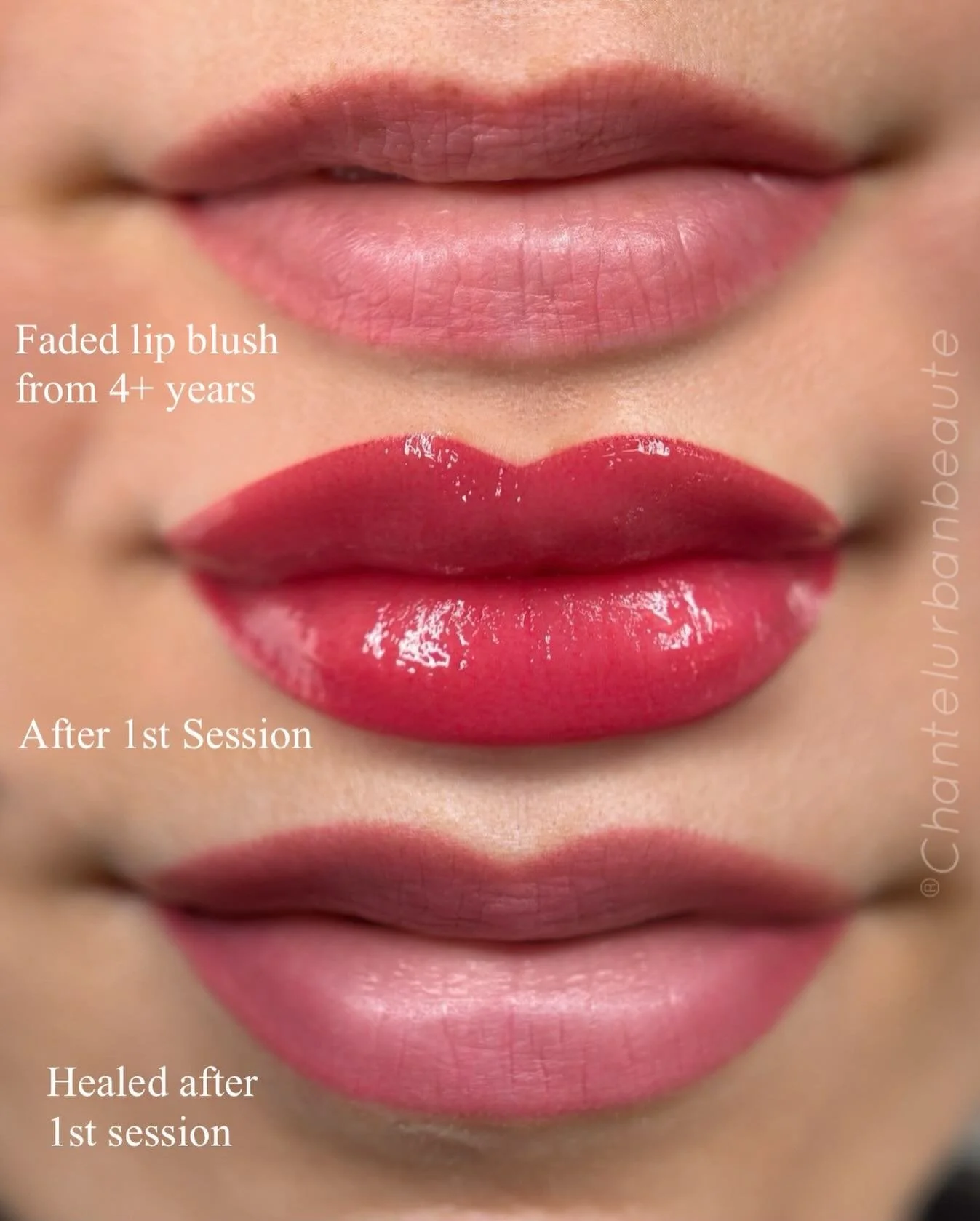 I did my clients lip blush years ago and finally she came back for a much needed refresh driving all the way from Brooklyn, NY!
We love a vibrant pop of color, as you can see right after the procedure the color is very bold.
Once it heals the color s