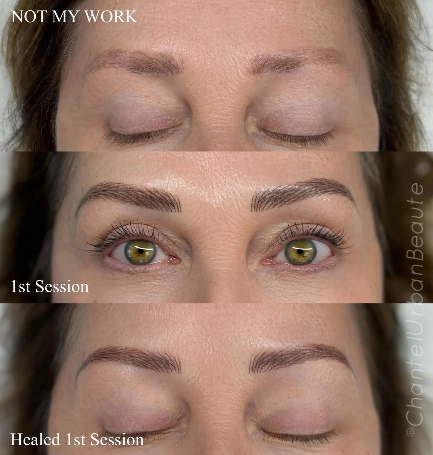 Nanostroke Brow Correction &amp; Cover-Up

Nanostroke brow cover-ups are among the most challenging procedures to perform. In many cases, nanostrokes can only be done on fresh, untouched skin to ensure seamless, natural results.

Fortunately, this cl
