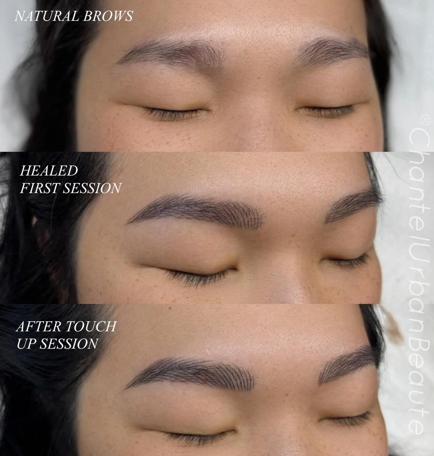 From barely there to effortlessly defined ✨
These NanoStroke brows healed soft and natural after the first session, then were perfected at the touch-up for the most seamless, fluffy finish 🤍

Proof that subtle enhancements make the biggest differenc