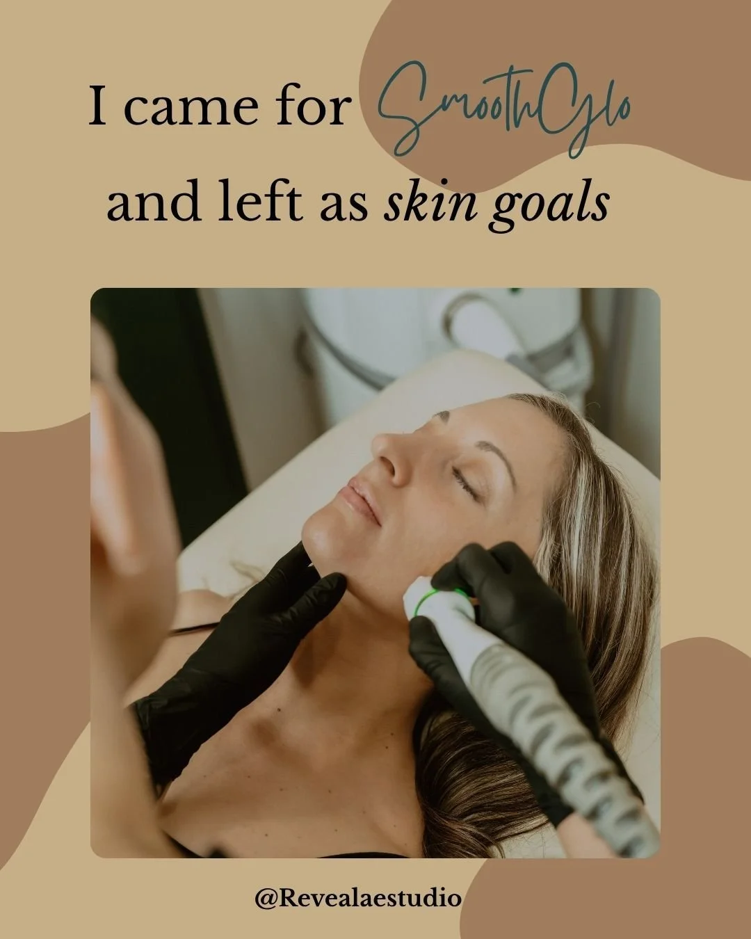SmoothGlo isn&rsquo;t just a facial, it&rsquo;s a full-skin reset. This treatment targets texture, tone, and dullness all in one; giving you that fresh, hydrated, &ldquo;I drink my water and mind my business&rdquo; kind of glow.

Come see why everyon