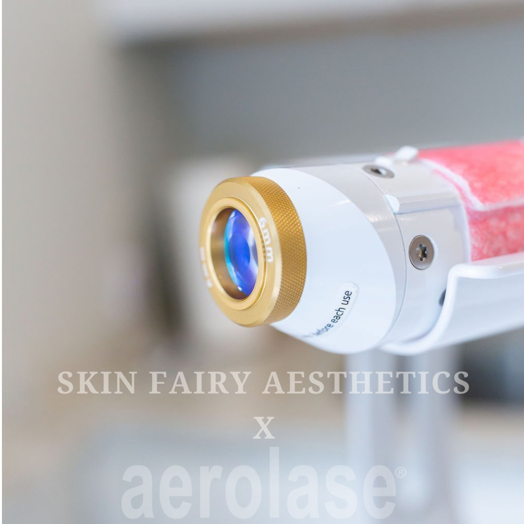 Aerolase laser acne treatment at Skin Fairy Aesthetics