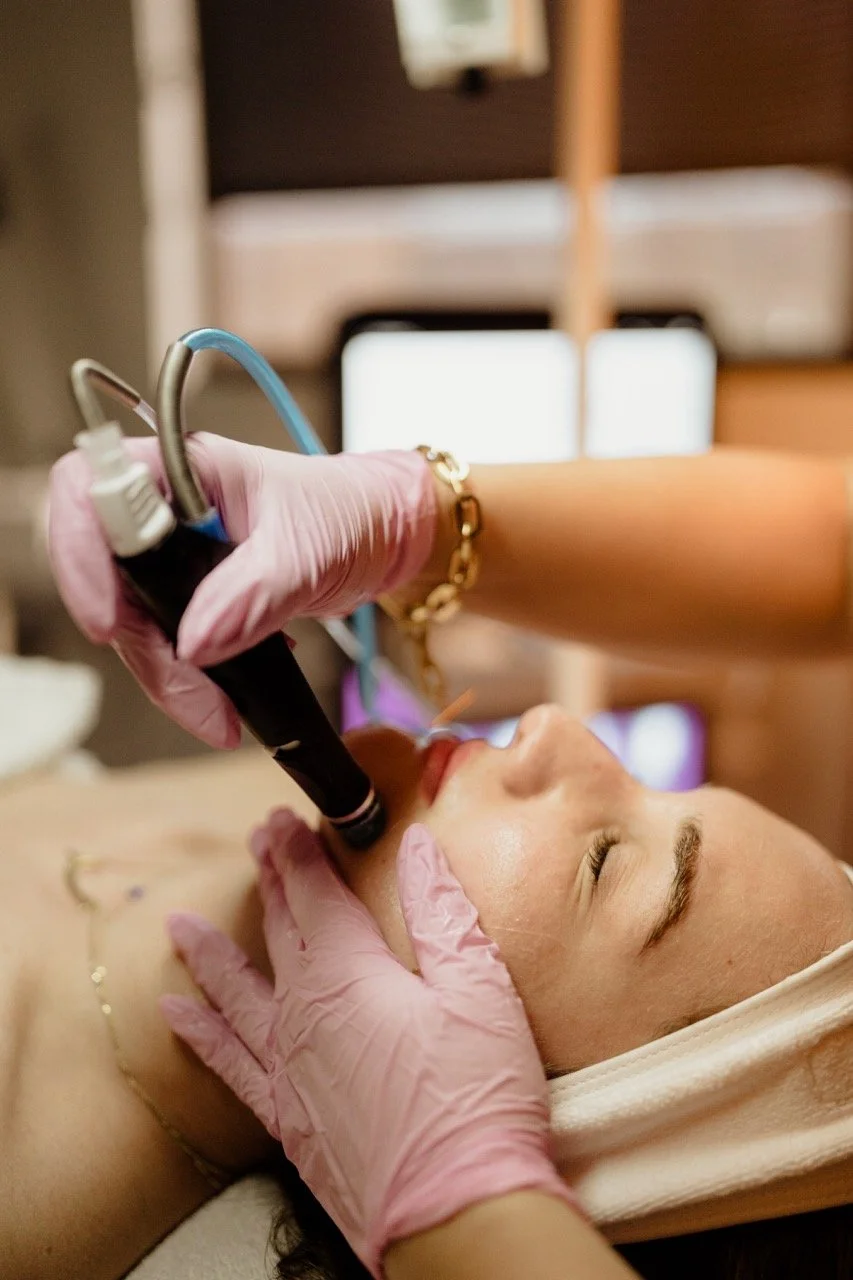 HydraFacial treatment in progress at Skin Fairy Aesthetics