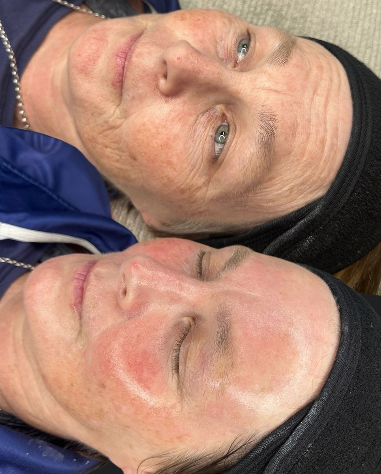 Korean Facial Phoenix Med Spa