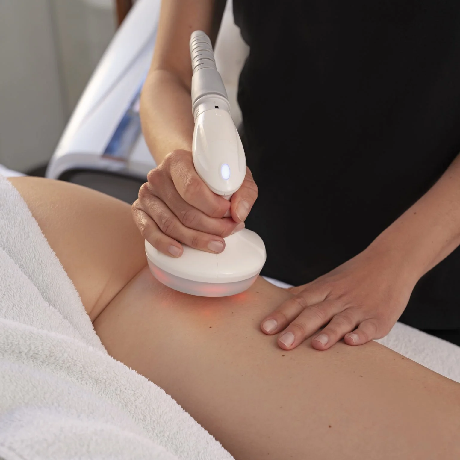 ¿Por qué la celulitis vuelve una y otra vez? La importancia de tratarla de forma integral