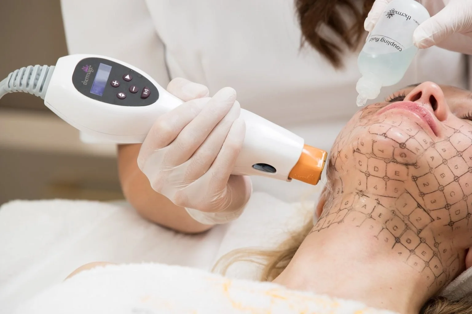Thermage: cómo estimular el colágeno para tratar la flacidez facial sin cirugía