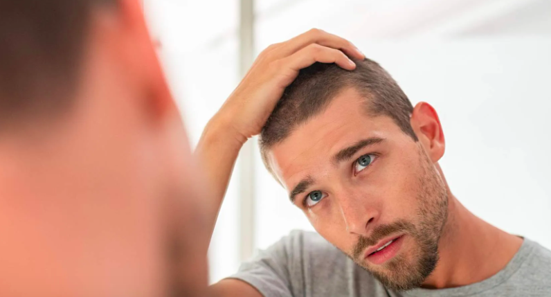 Caída del pelo en hombres: las señales que pueden indicar que estamos ante una alopecia