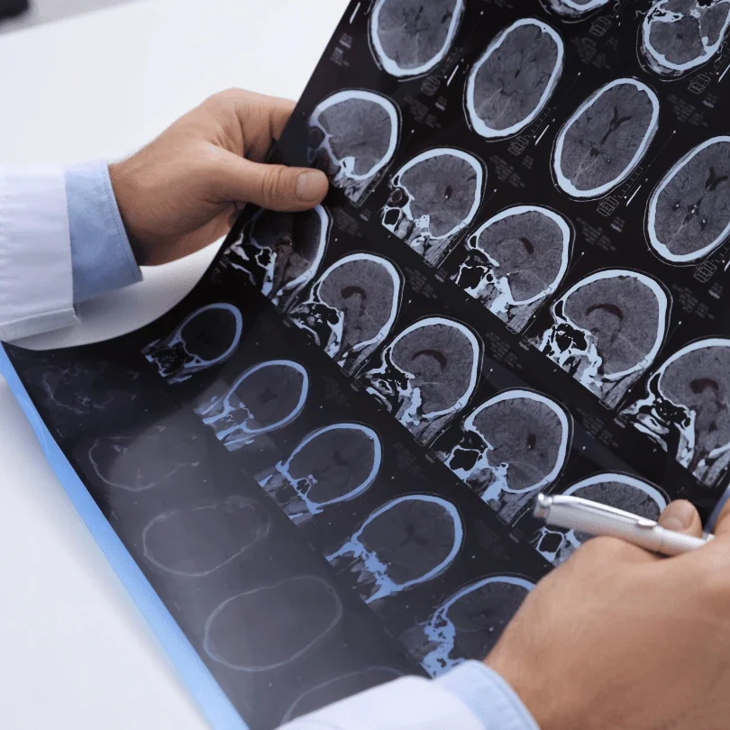 Bounce Back Anew: Comprehensive Concussion Care for Lasting Recovery in Calgary