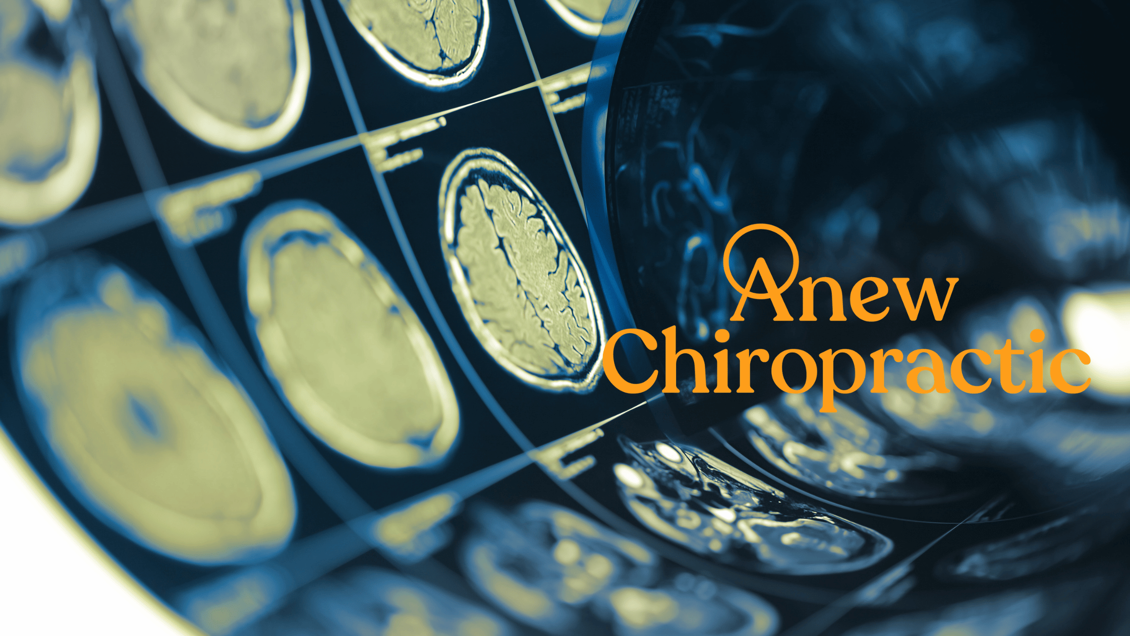 Concussion Scans, show brain scannings with Anew Logo
