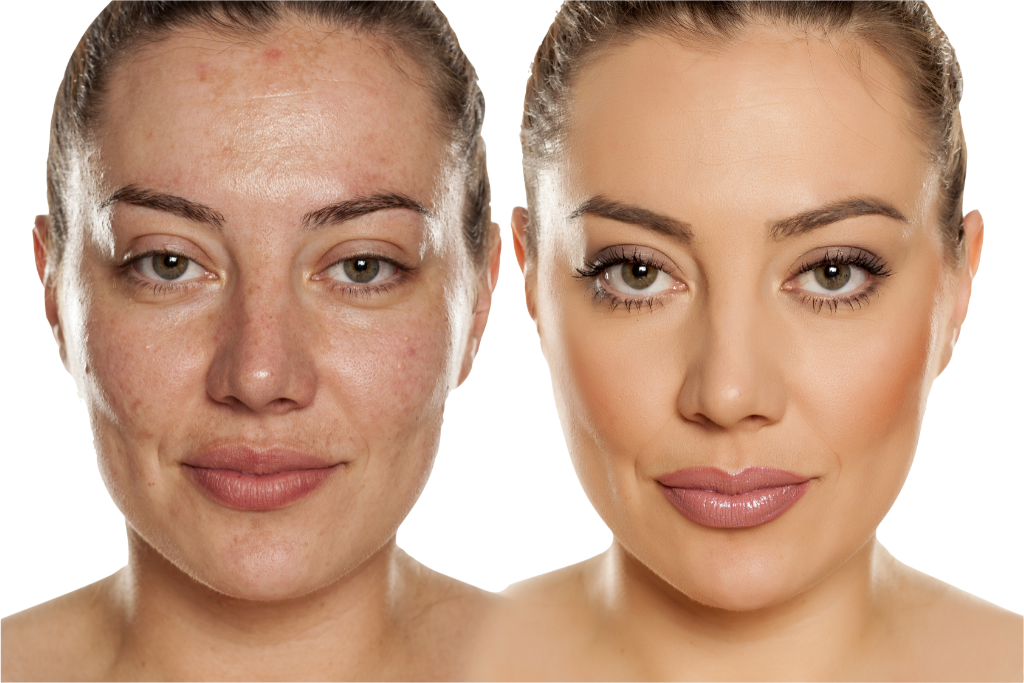 BEFORE AND AFTER PHOTOSHOOP.png