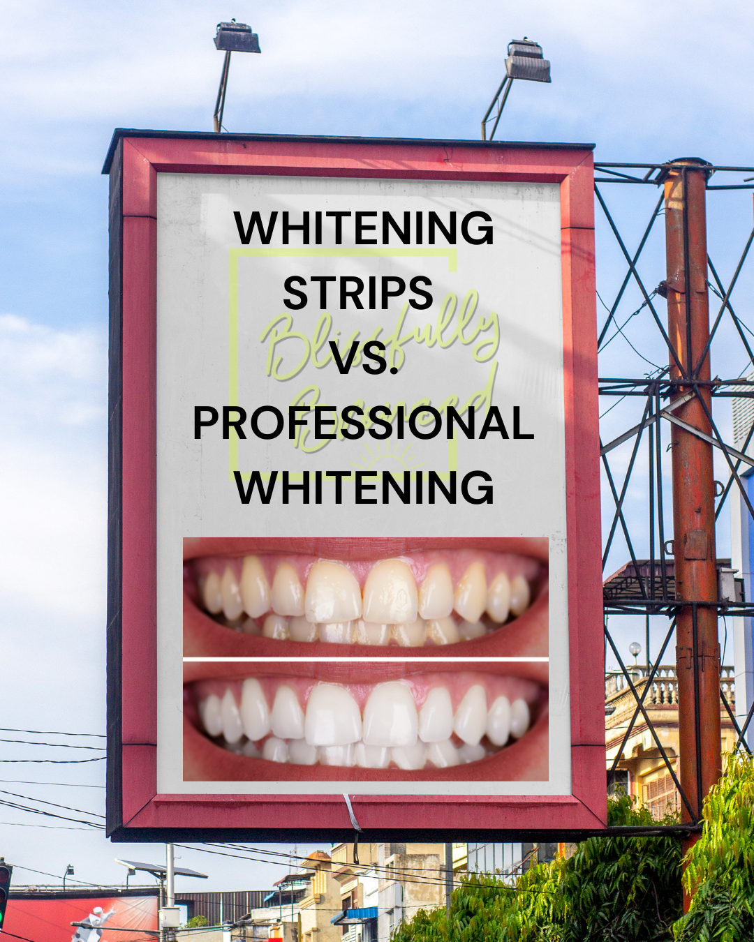 Professional Teeth Whitening vs. Whitening Strips: What's the Difference?