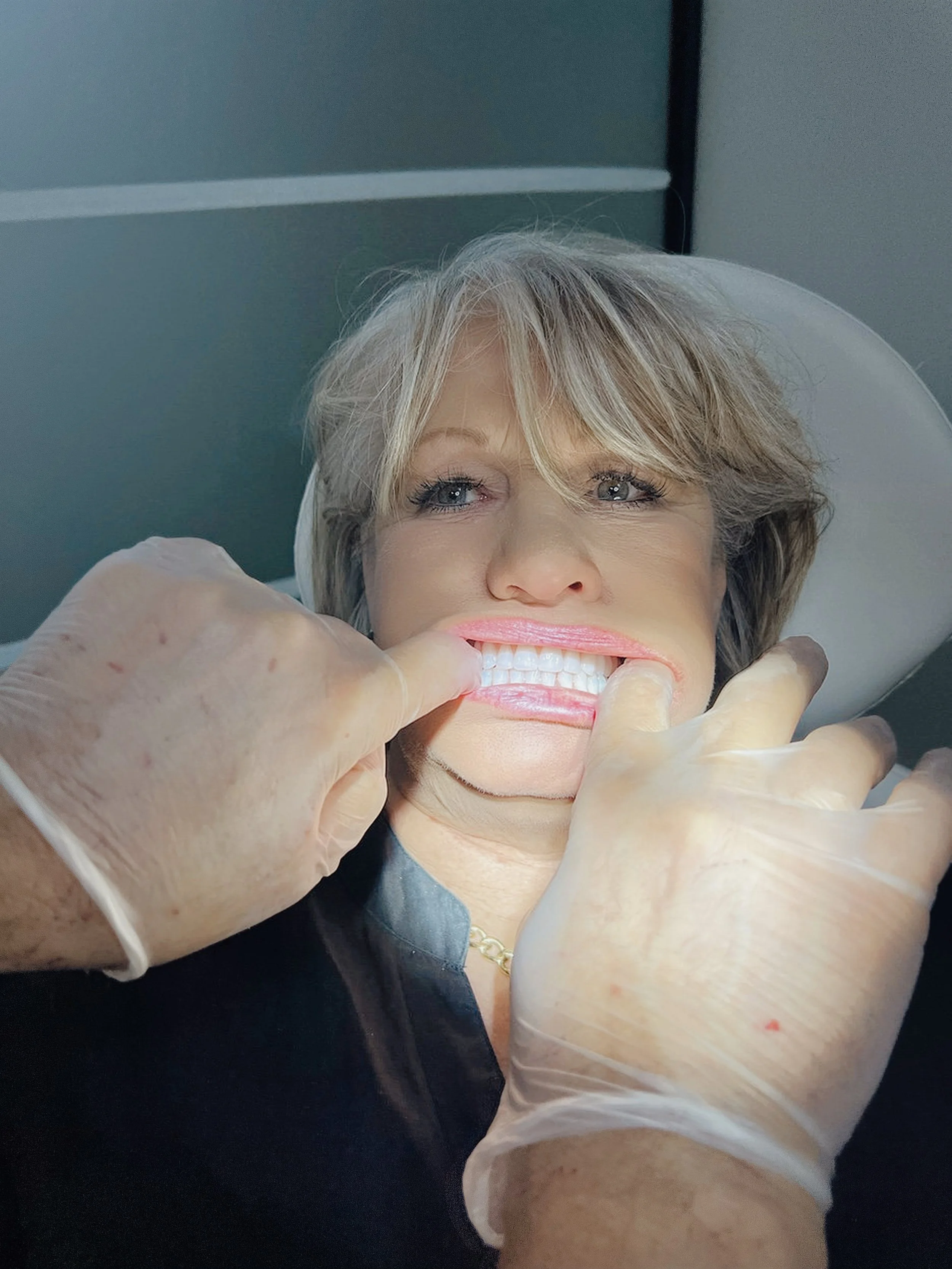 Full upper and lower dentures Melbourne, dental prosthetist Preston.

Led by Dr. Sebastian Riggio, a prosthetist with over 35 years of experience.