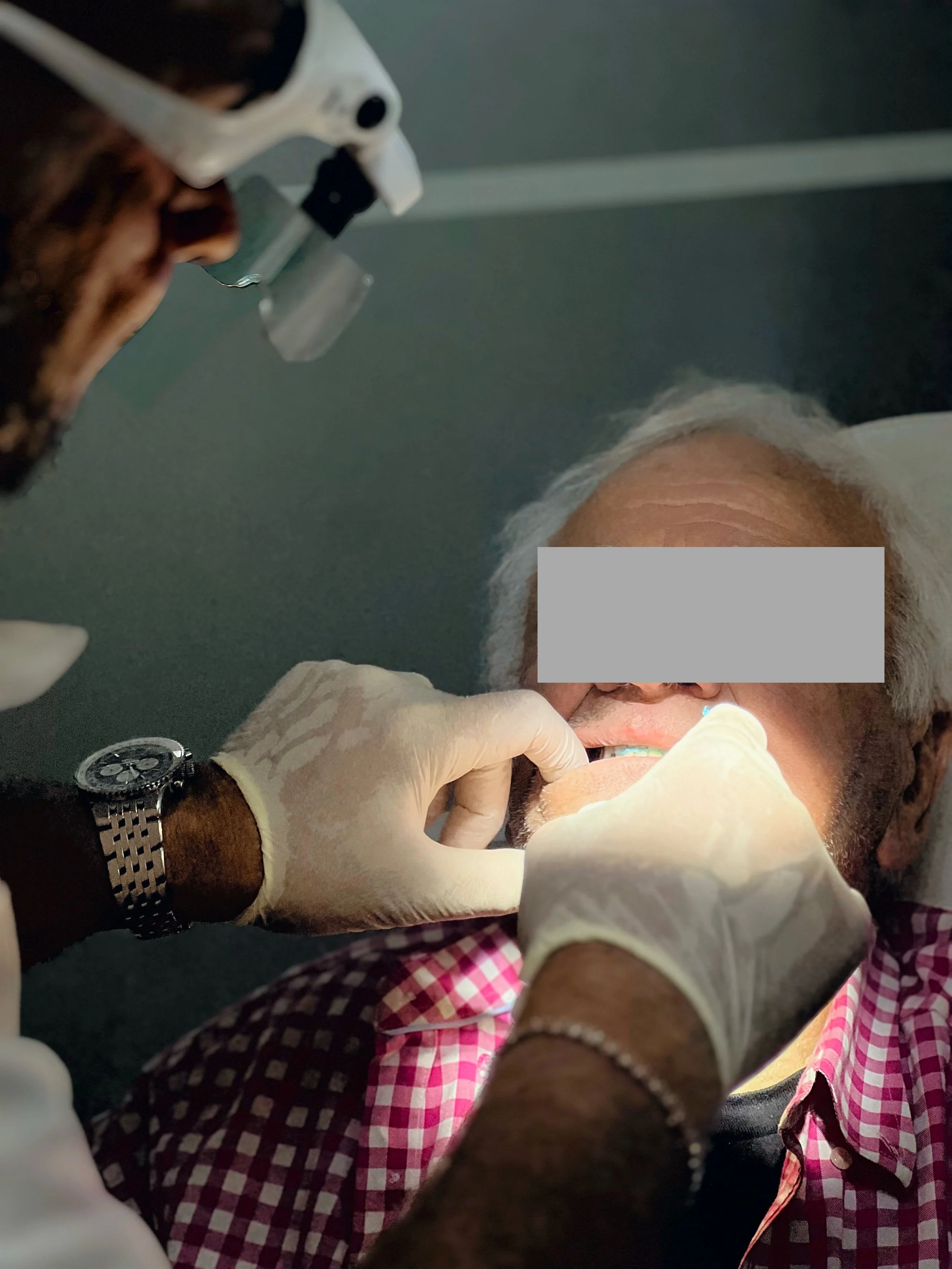 Denture bite registration process