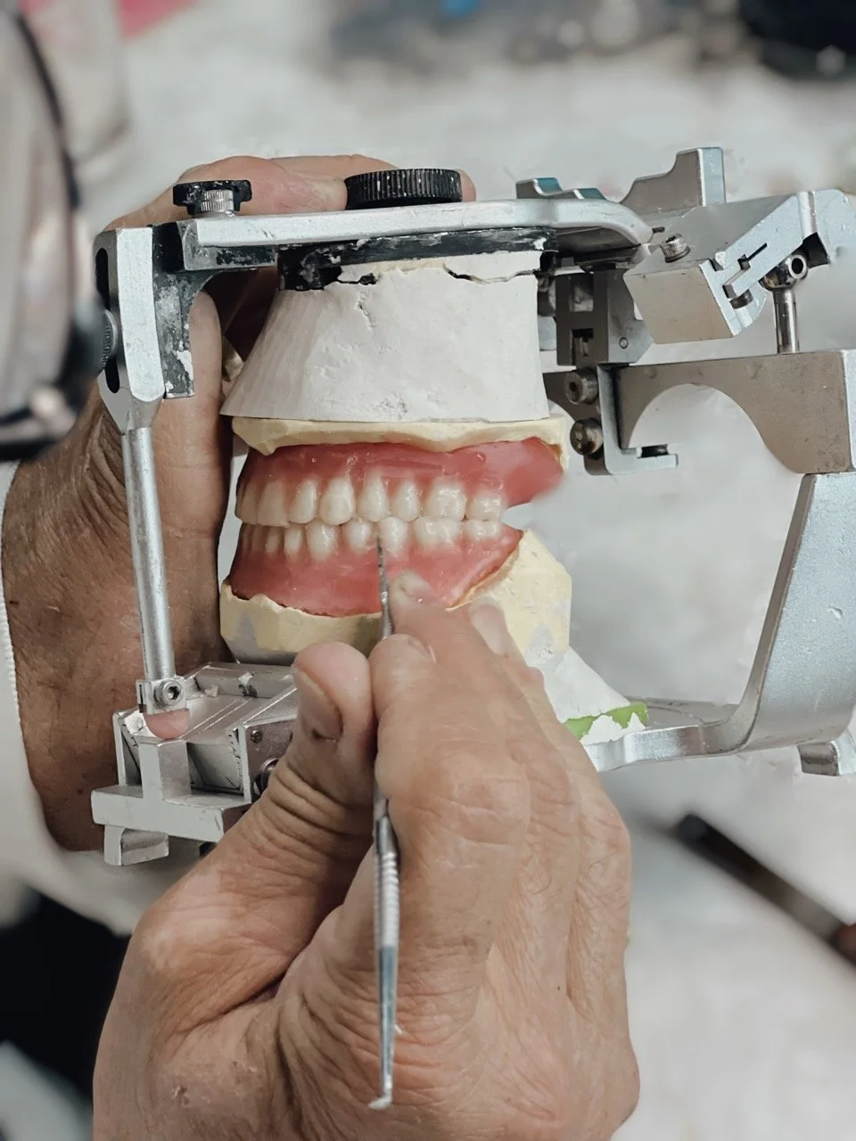 A custom denture being engineered in-house to ensure perfect alignment and a natural aesthetic.