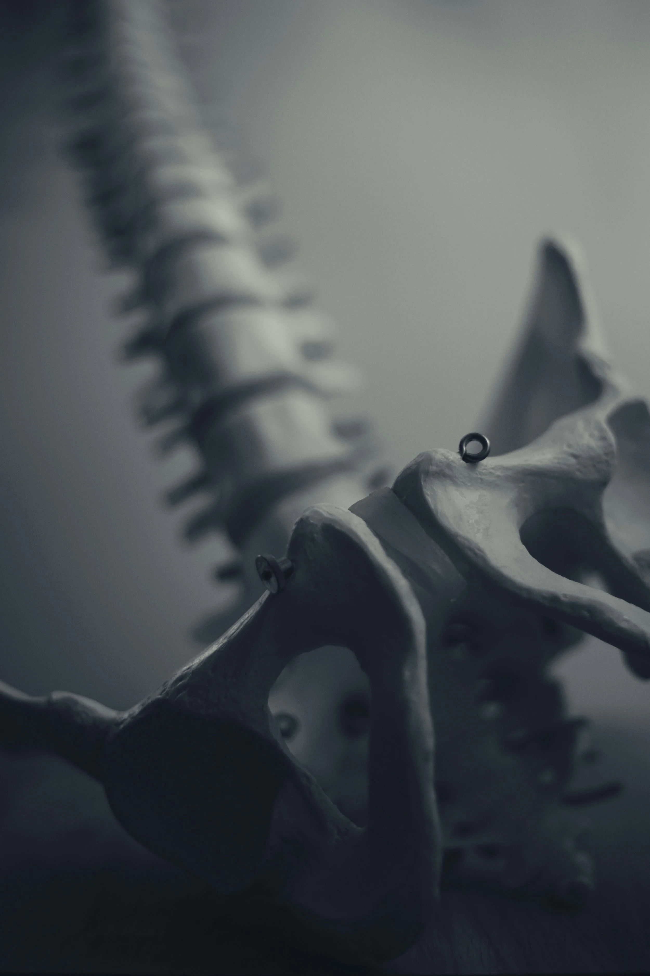 How to Protect Your Bones in Perimenopause: Tests, Nutrition, Exercise and HRT