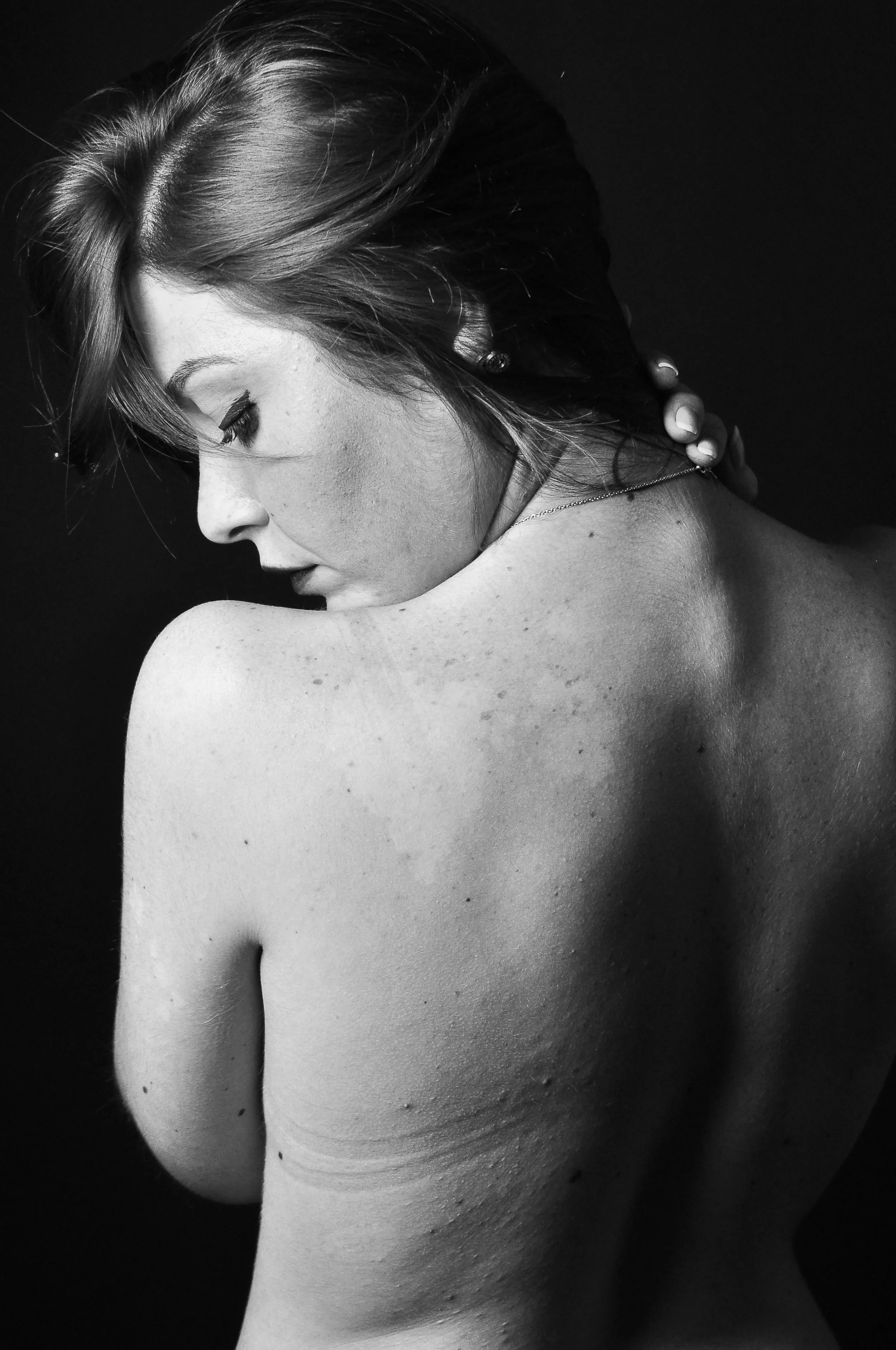 Endometriosis Isn't Just "Too Much Oestrogen." Here's What's Really Happening