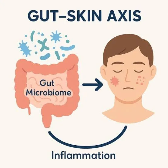 The Gut-Skin Connection: How Your Digestive Health May Influence Your Skin