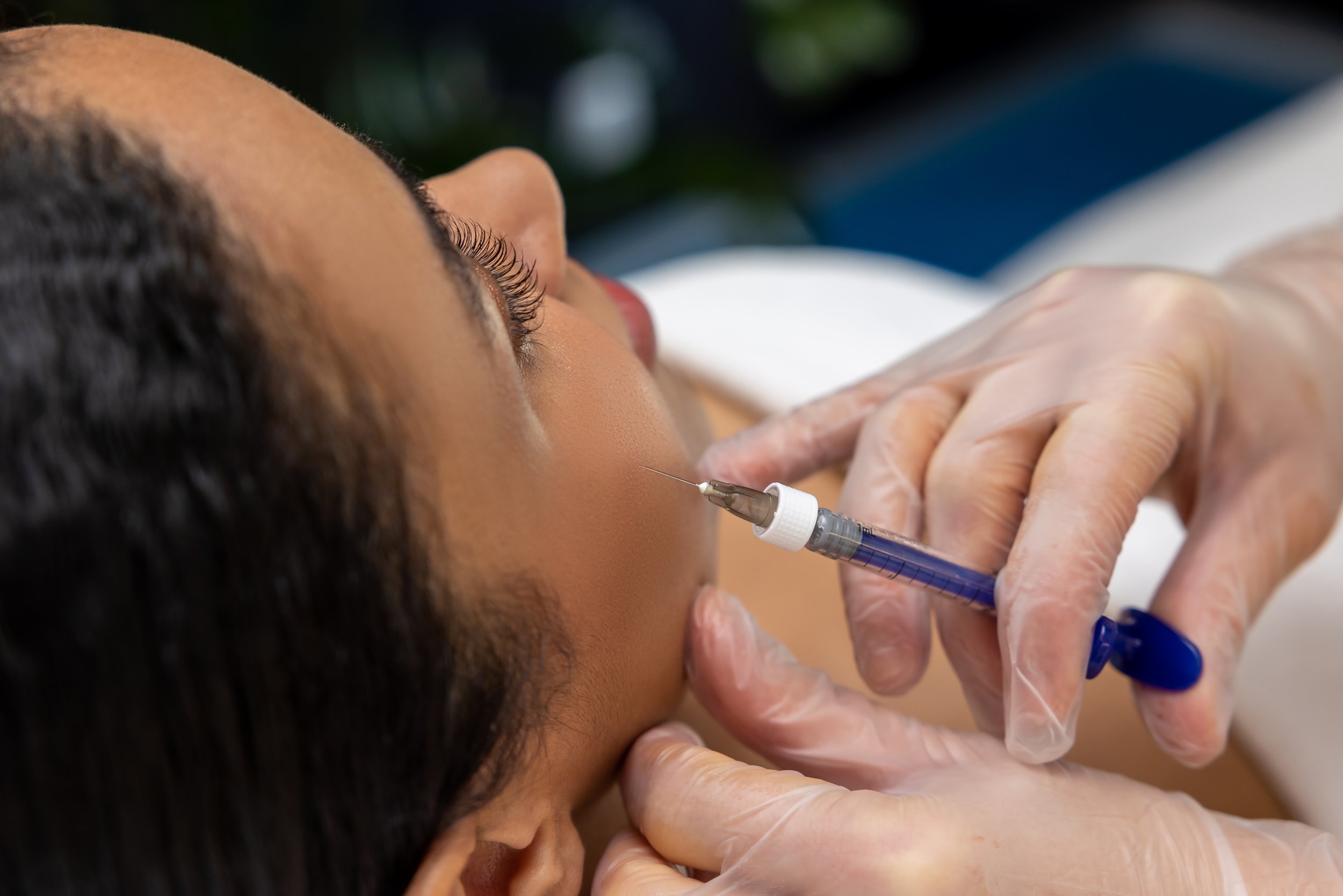 fillers-in-korea-seoulglow.jpg