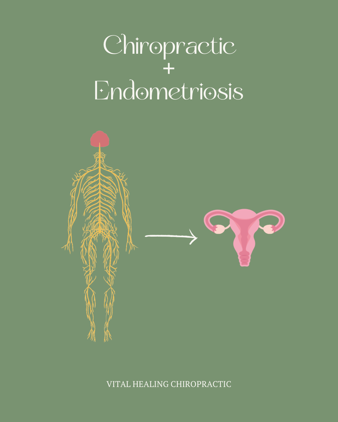 Chiropractic and endometriosis - a picture of the body outlining the entire nervous system and a picture of a uterus