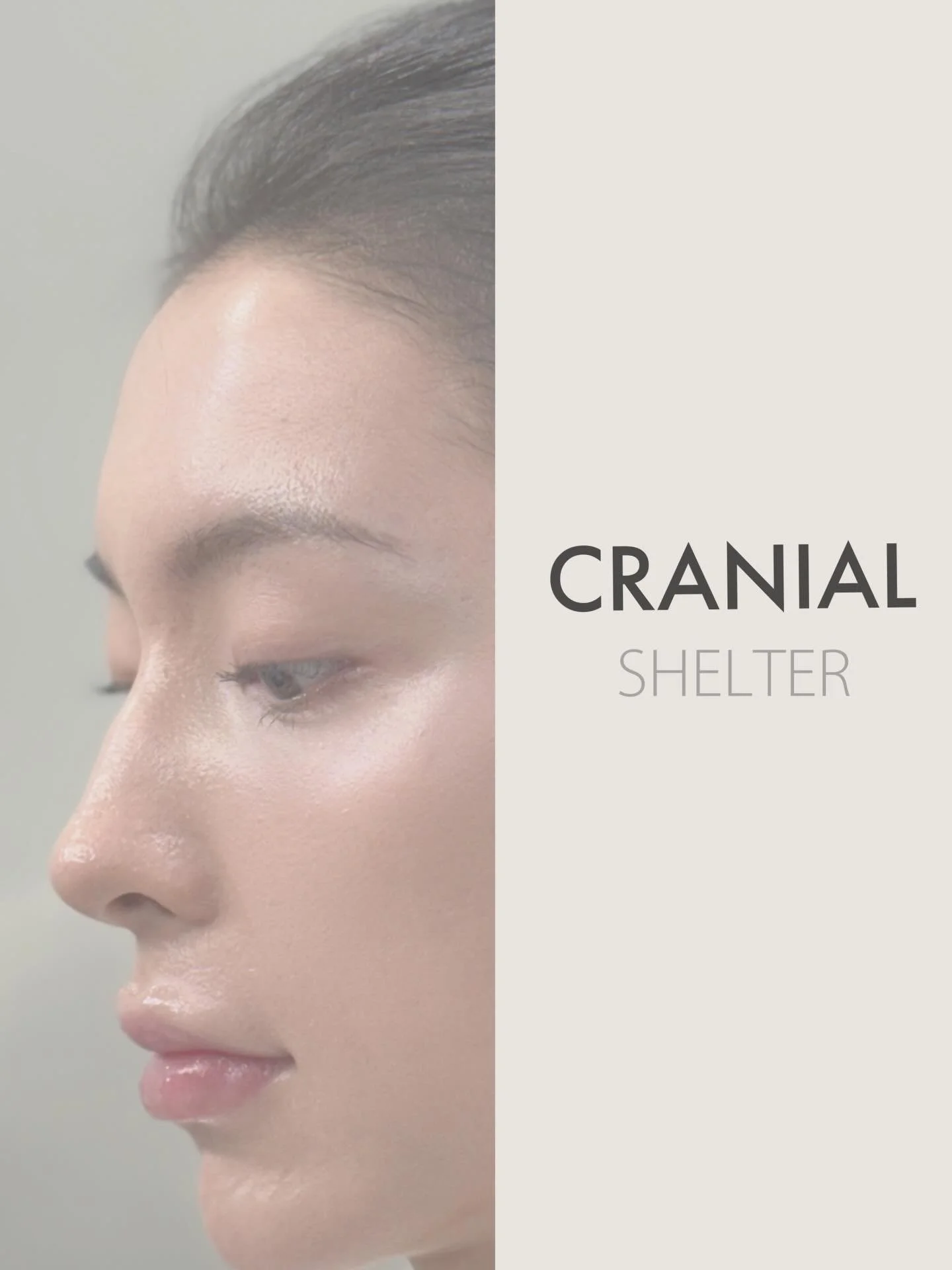 Most people don&rsquo;t think about this area.

But the crania top and upper forehead region act as a kind of &ldquo;cranial shelter&rdquo;&mdash;they frame the face and influence how everything below is perceived.

When this support is weak or flatt