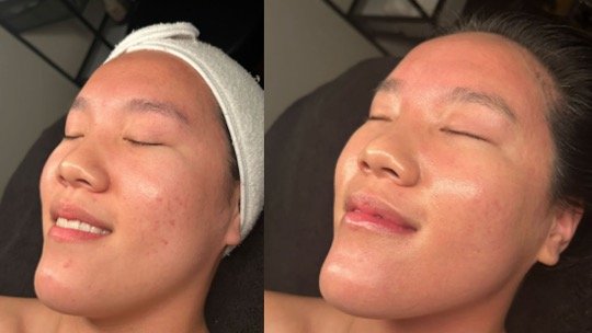 1 CELLSTORY @enchanted.skinstudio.jpeg
