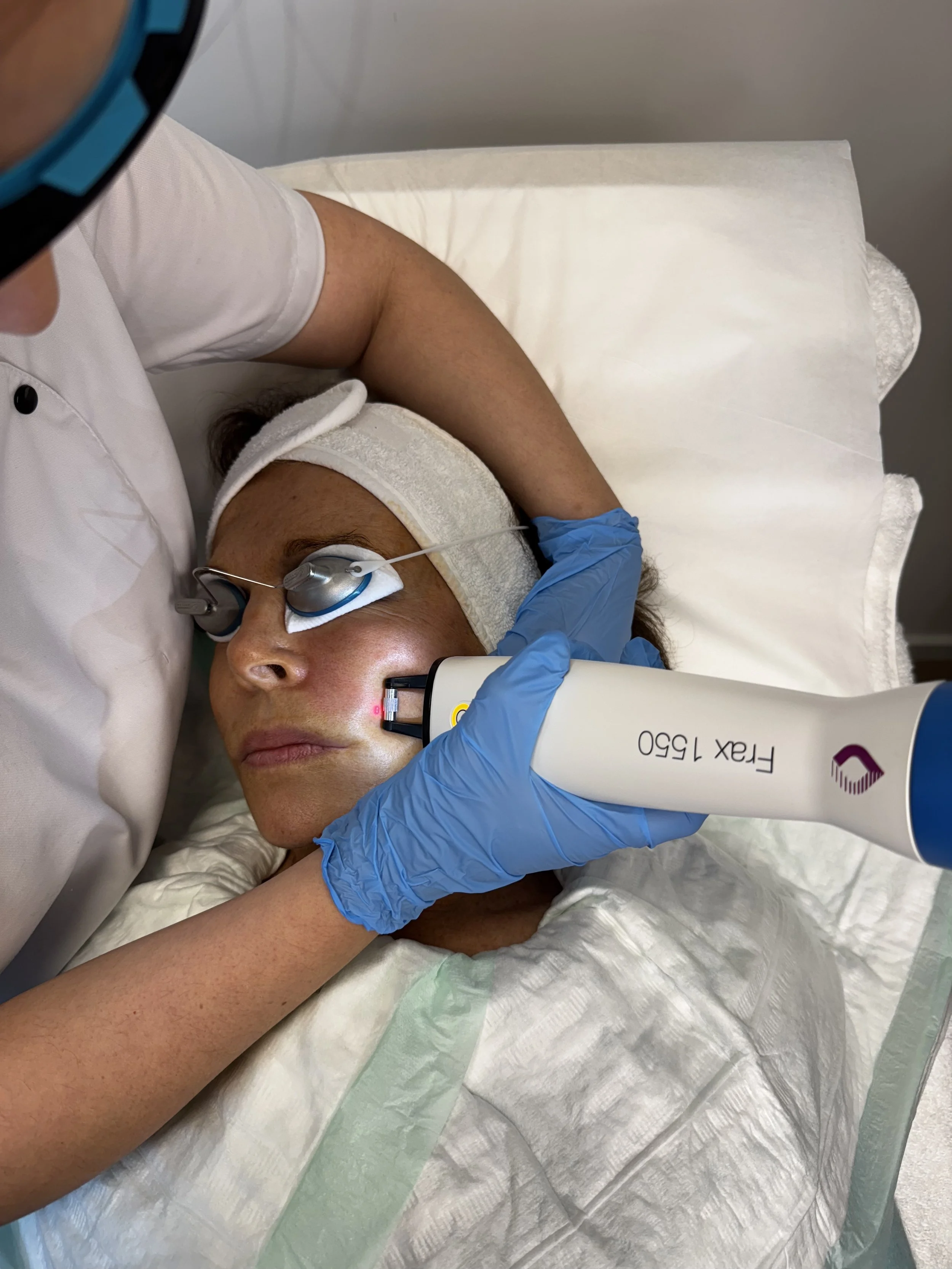 Le Laser Fractionné : Dalton Frax 1530! 