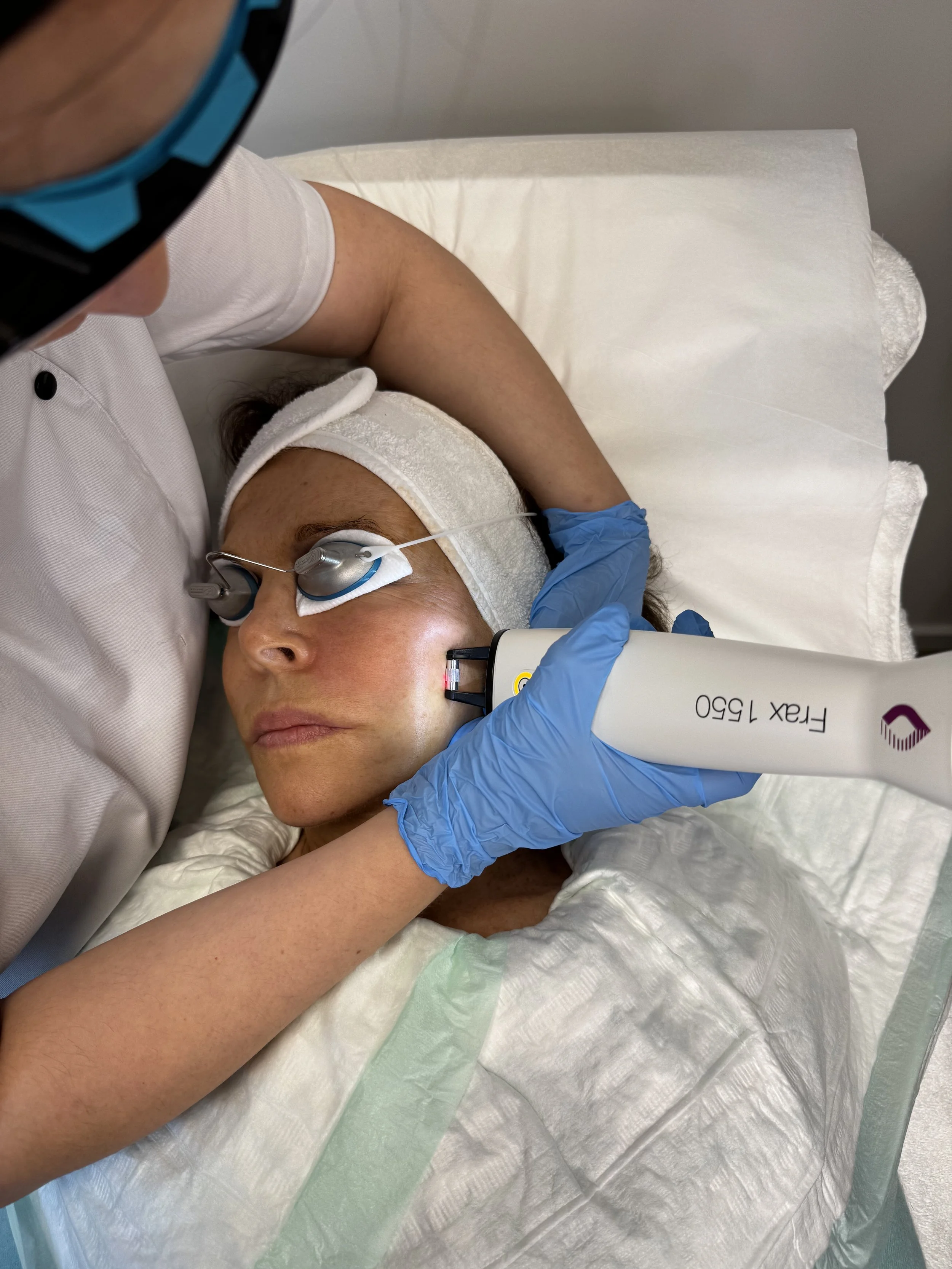 LASER Nordlys FRAX - Traitement Laser rajeunissant non ablatif (Visage)