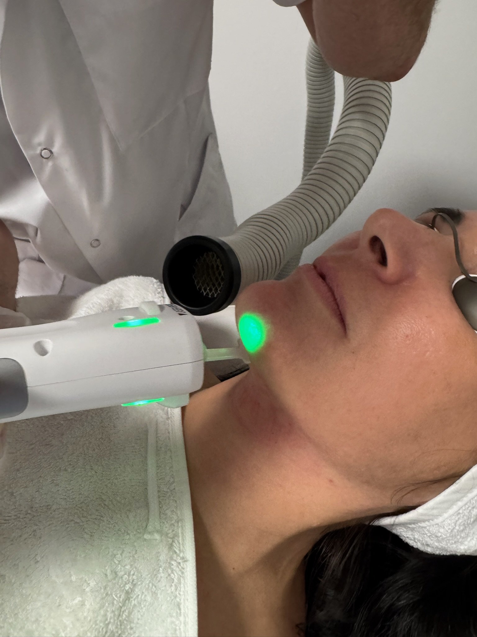 Infinity MRF -Rajeunissement et Fermeté par Radiofréquence à Micro-aiguilles