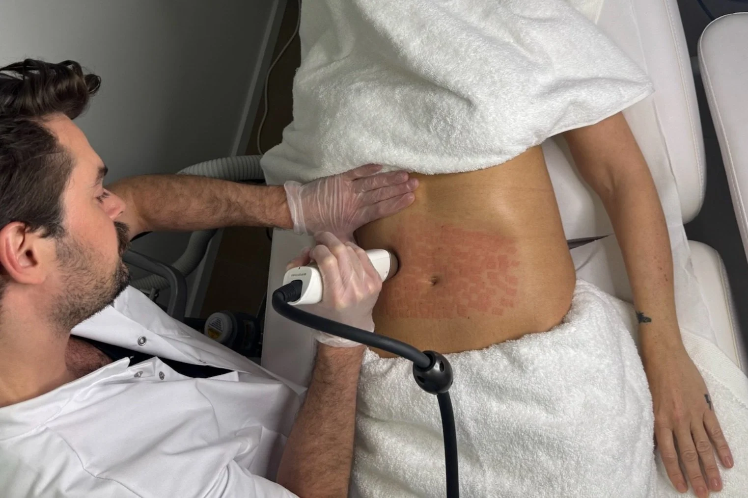 Traitement Relachement Cutané