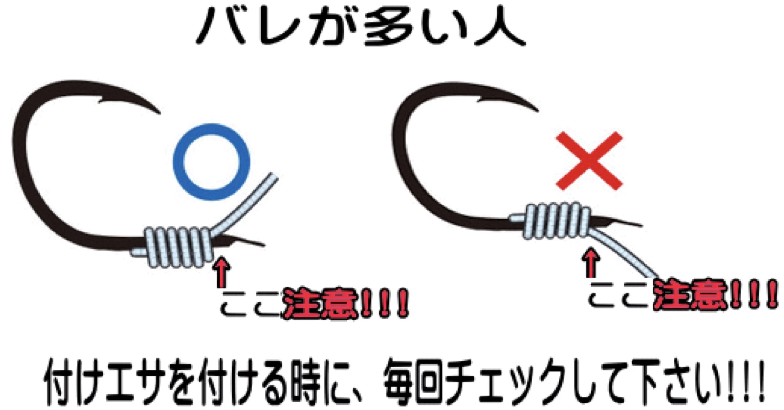 唇にワイヤーを巻き付ける正しい方法と間違った方法を示したイラスト。正しい方法は左側の図で、ワイヤーを唇の内側に巻き付けている。間違った方法は右側の図で、唇の外側に巻き付けている。注意喚起の赤文字と矢印あり。