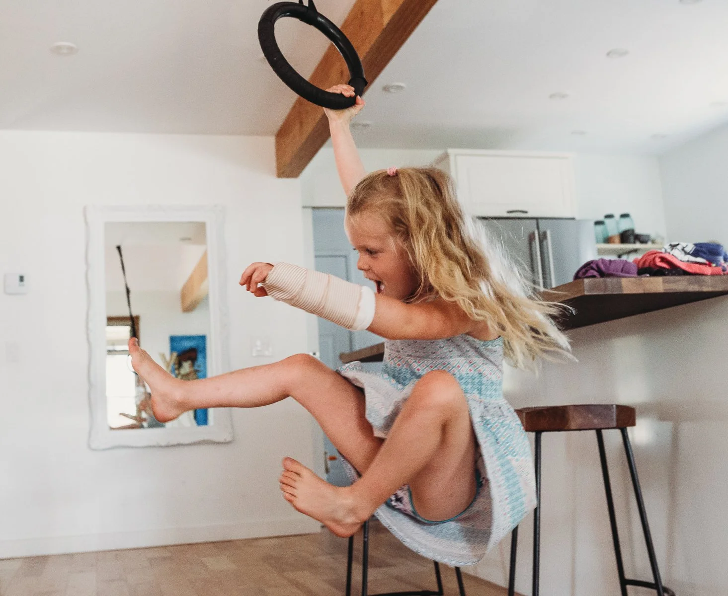 Young girl playing on a gymnastic ring in a living room, wearing a sundress and arm bandage.