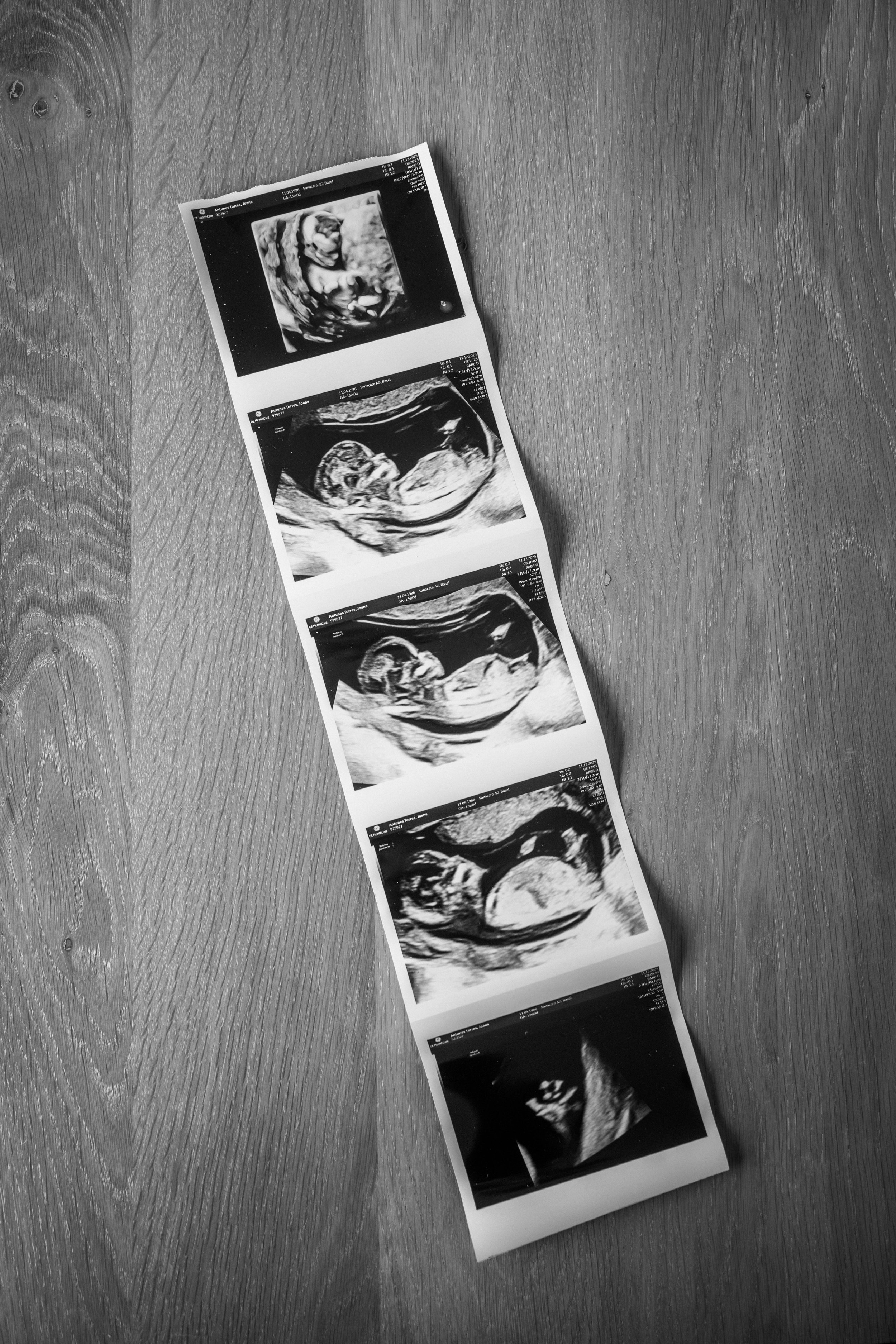 12 weeks and sooo much detail