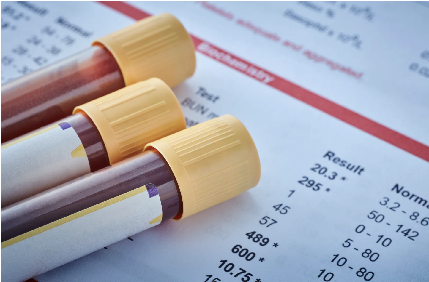 Interpreting Blood Results: Why 'Normal' Isn't Always Optimal – A Nutritionist's Guide to Preventative Health