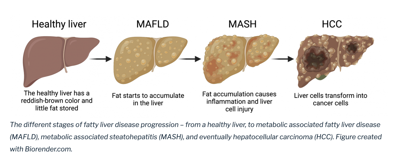 All About Liver Health: Why Metabolic Chaos Is Fuelling a Silent Epidemic