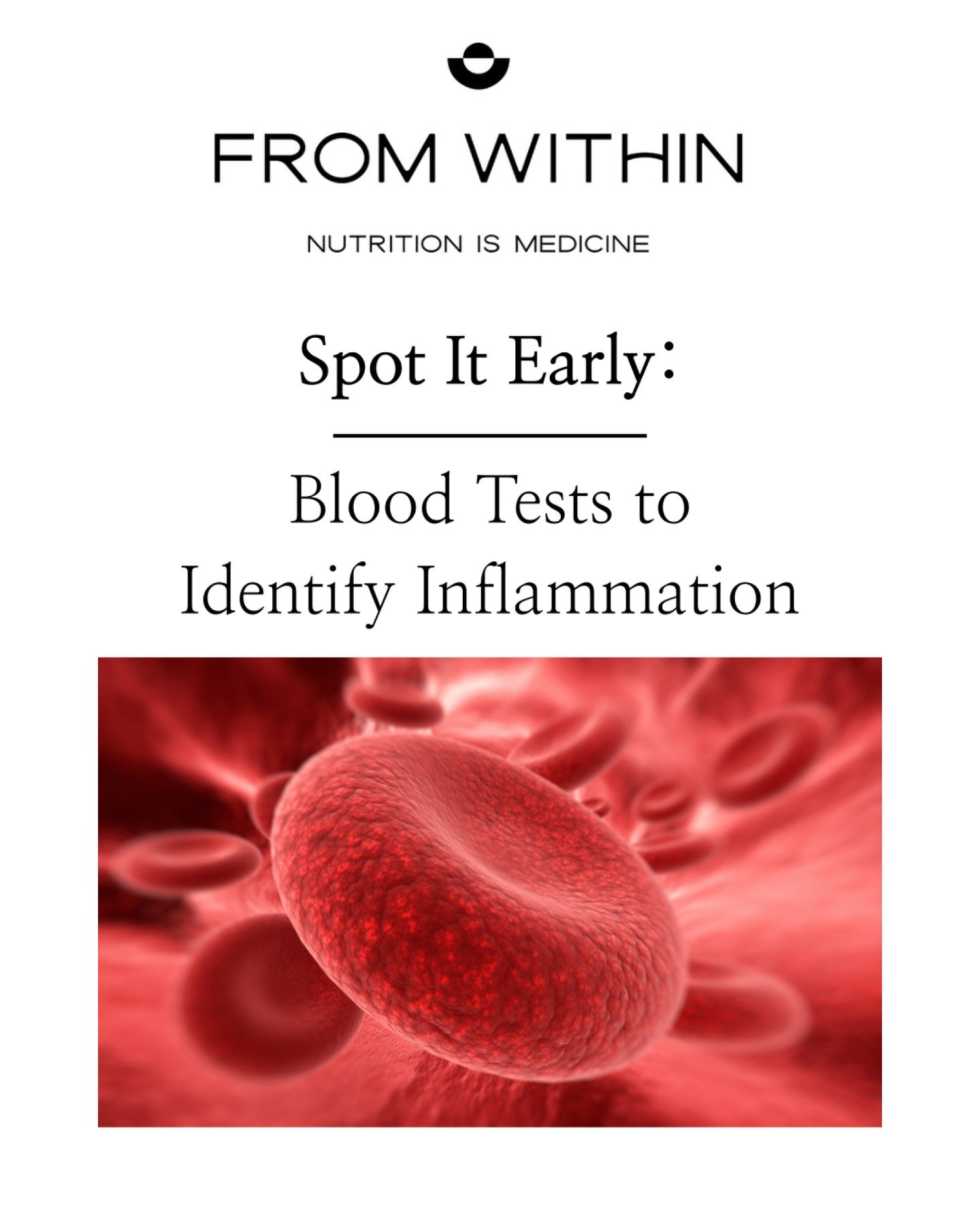 Silent inflammation? Catch it by testing CRP (140 hints at activity). These tests can help identify systemic inflamation, predict IBD flares or heat risks. FROM WITHIN&rsquo;s blog, Understanding Inflammation: Detection, Impacts, and Mitigation Strat