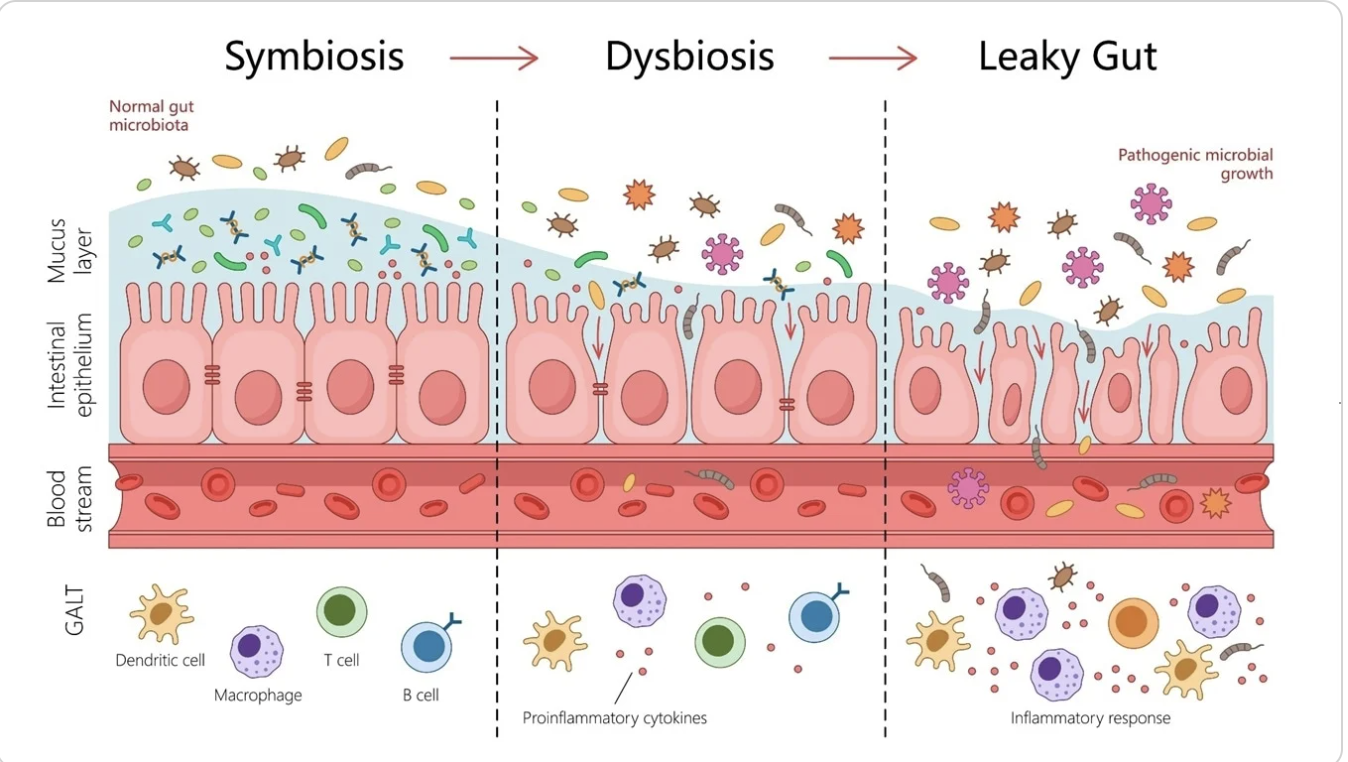 Understanding Leaky Gut: Symptoms, Causes, and How to Heal Your Gut