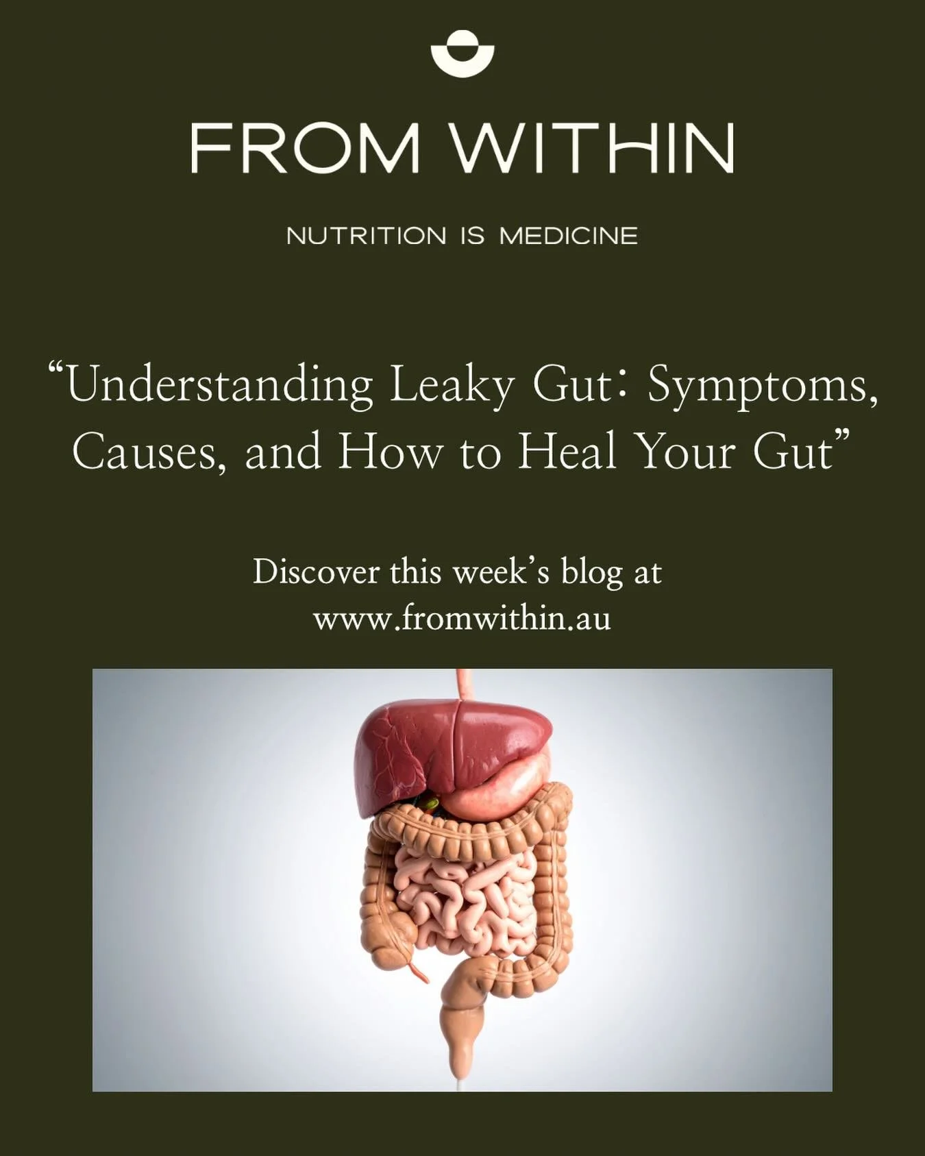 Bloating. Brain fog. Food sensitivities. Fatigue.

&ldquo;Leaky gut&rdquo; is a term that&rsquo;s everywhere &mdash; but what does it actually mean?
In this week&rsquo;s blog, I break down:  
💡What increased intestinal permeability really is  💡The 