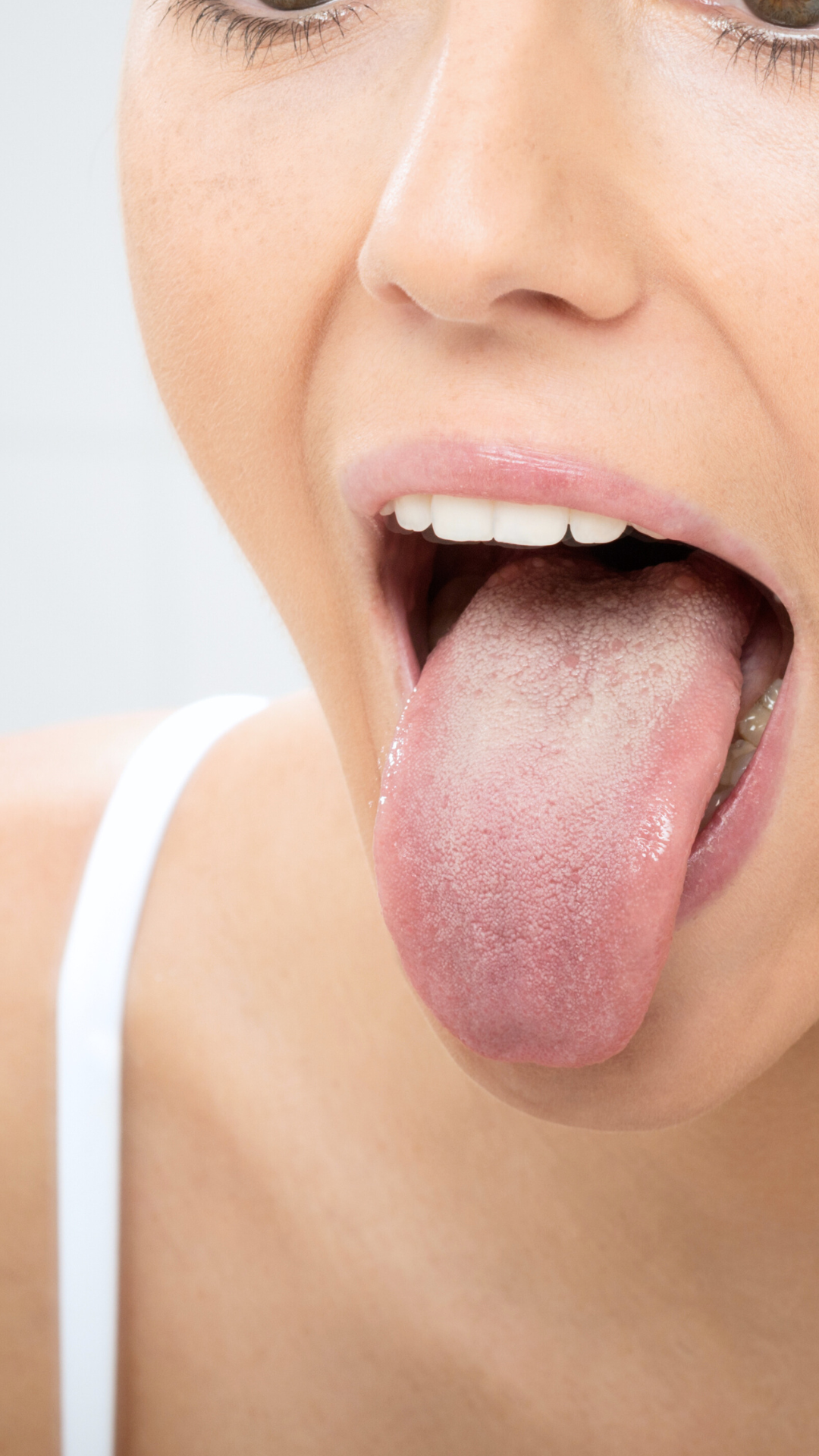 Myofunctional Therapy