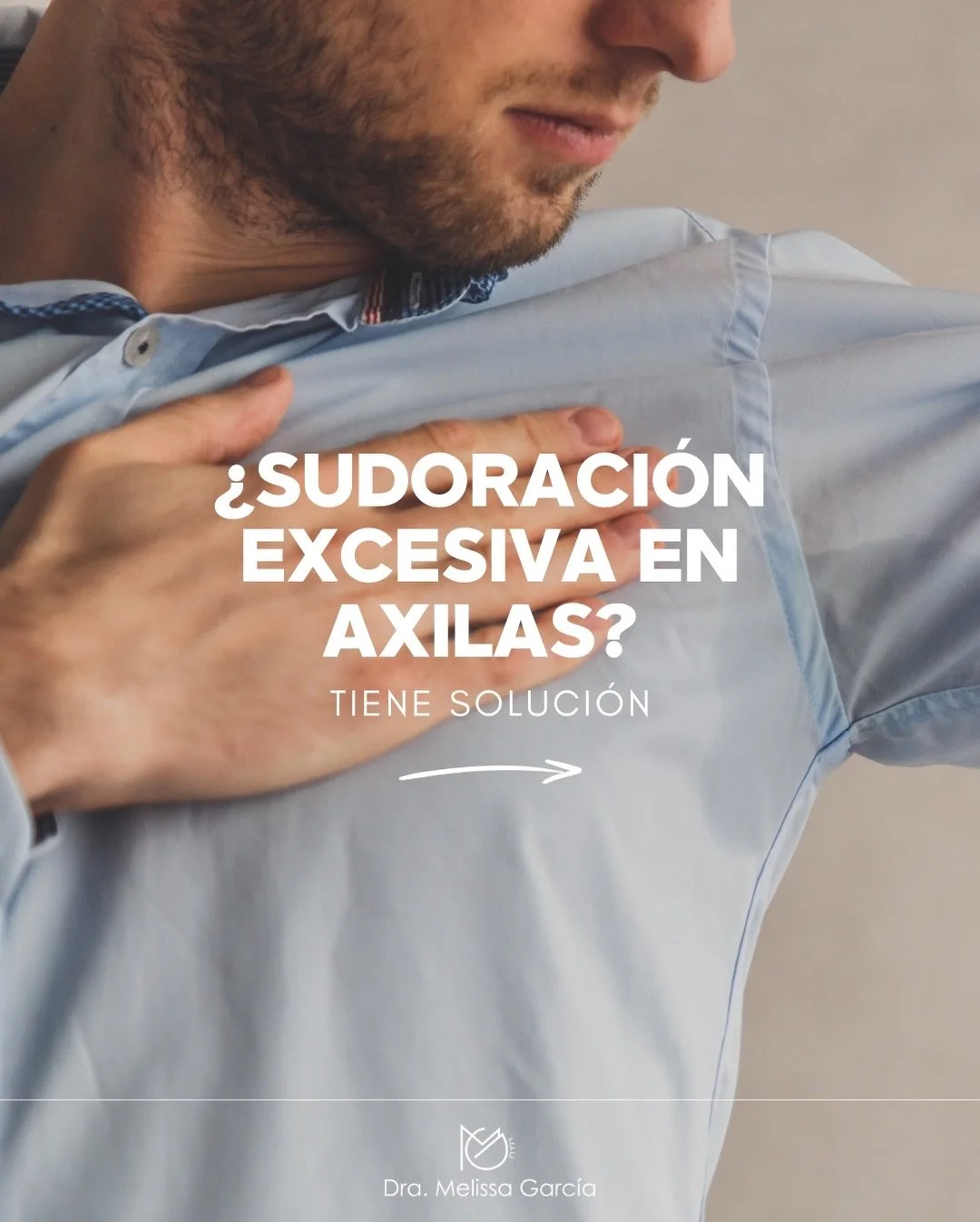 &iquest;Sudoraci&oacute;n excesiva en las axilas? 💦
No es normal. Y s&iacute;, tiene soluci&oacute;n.#hiperhidrosis #sudor #m&eacute;dicinaest&eacute;tica #sudoraci&oacute;n  #neuromoduladores 

La hiperhidrosis axilar es una condici&oacute;n m&eacu
