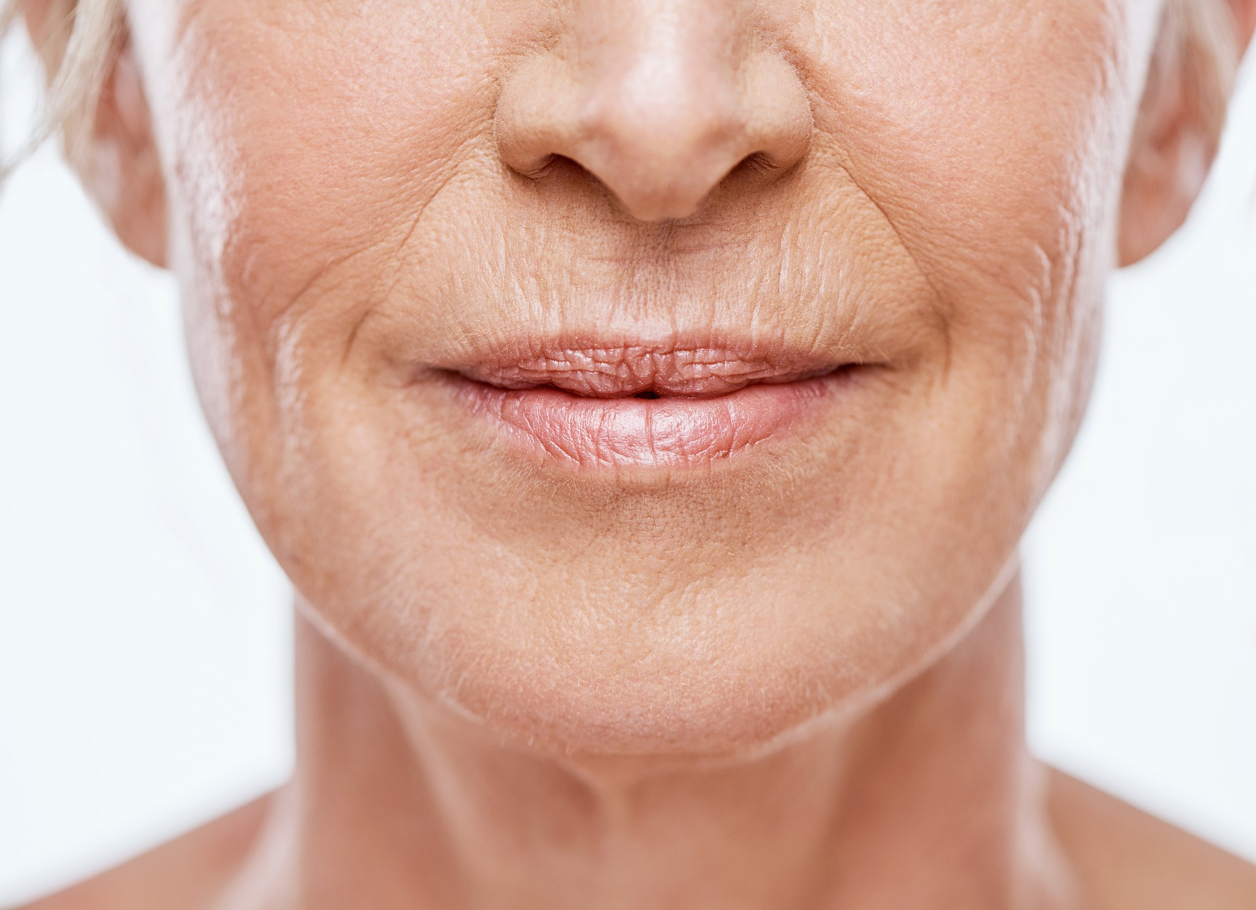 Armonización Facial o Full Face en Barcelona con Técnica FaceXculpt.