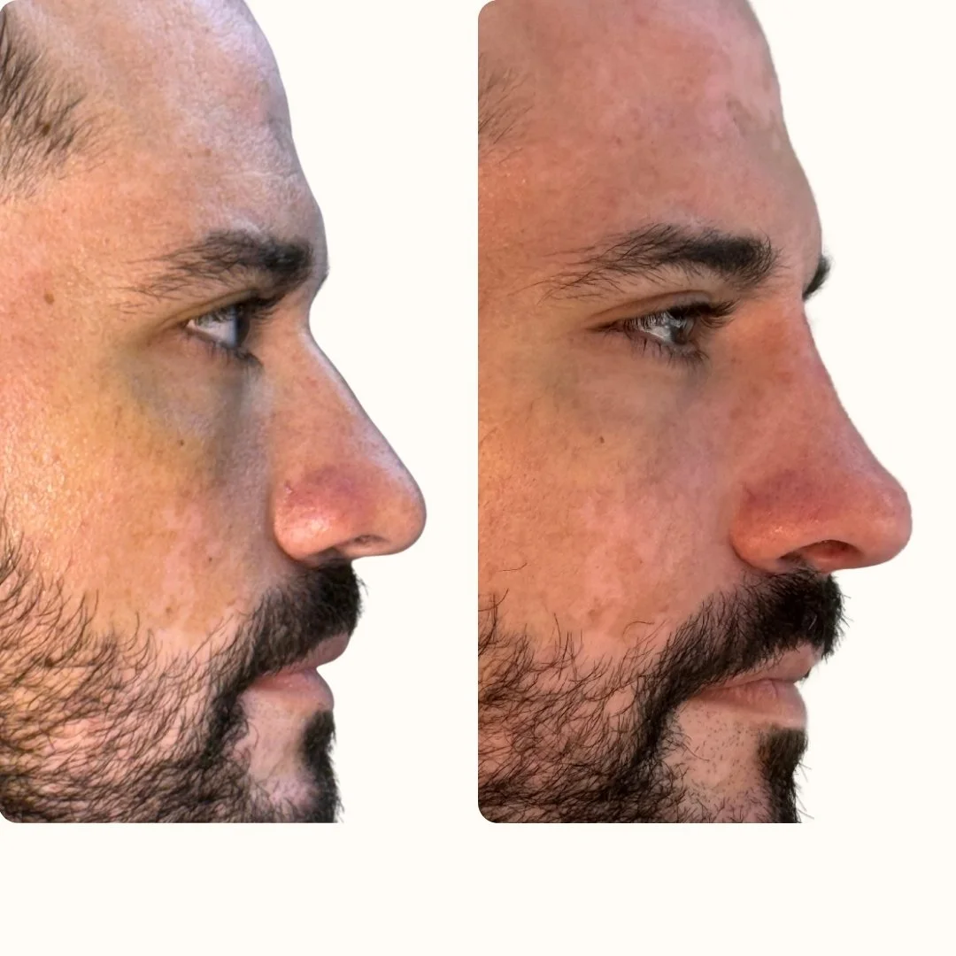 RINOMODELACIÓN BARCELONA