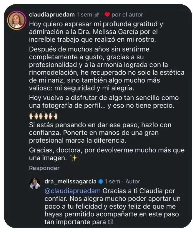 Facexculpt- armonización facial Barcelona