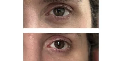 OJERAS BARCELONA