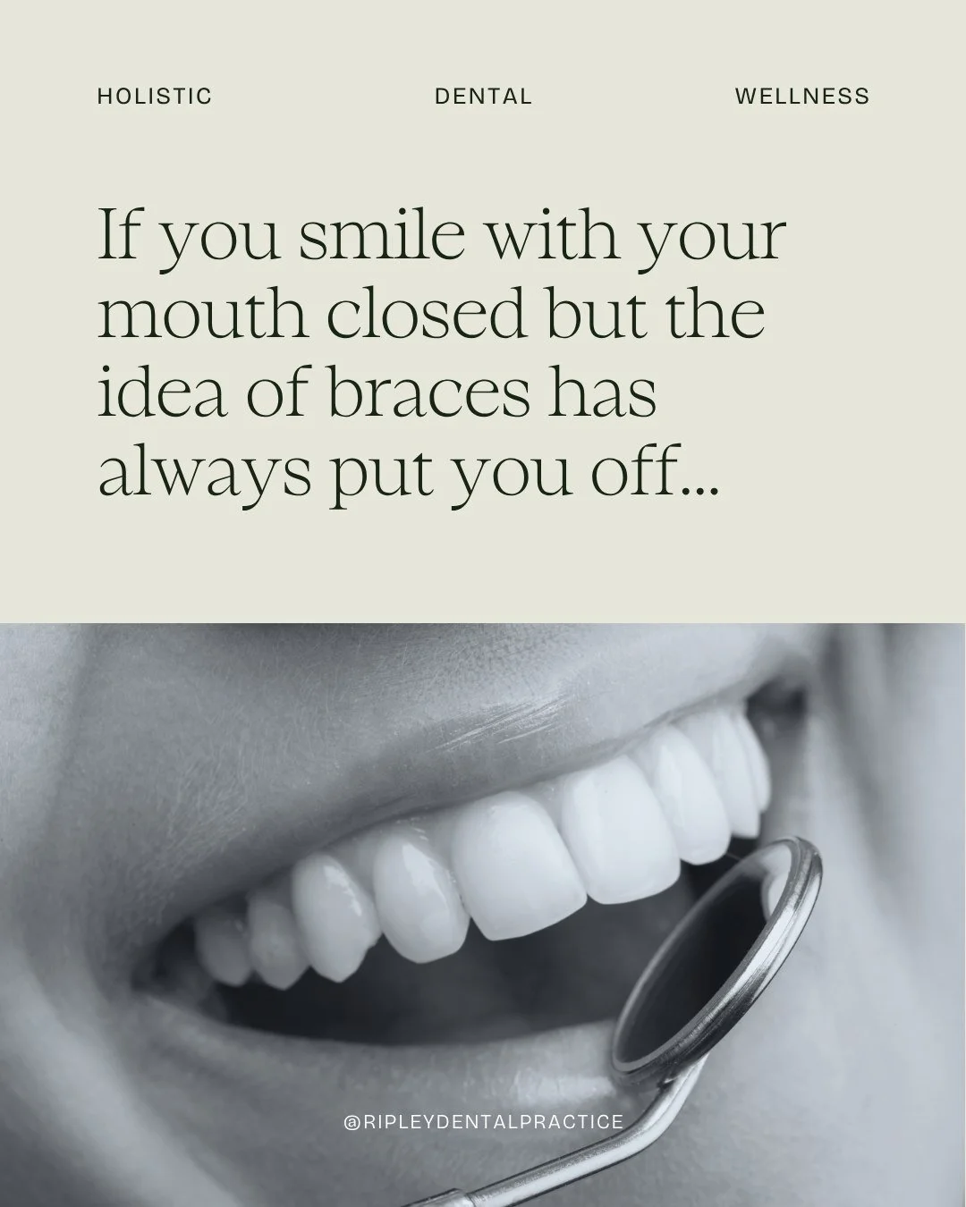 So many of the people we see have spent years quietly working around their smile, keeping their lips together in photos and holding back when they laugh, because traditional braces never felt right for them.

Aligners have changed that for so many of