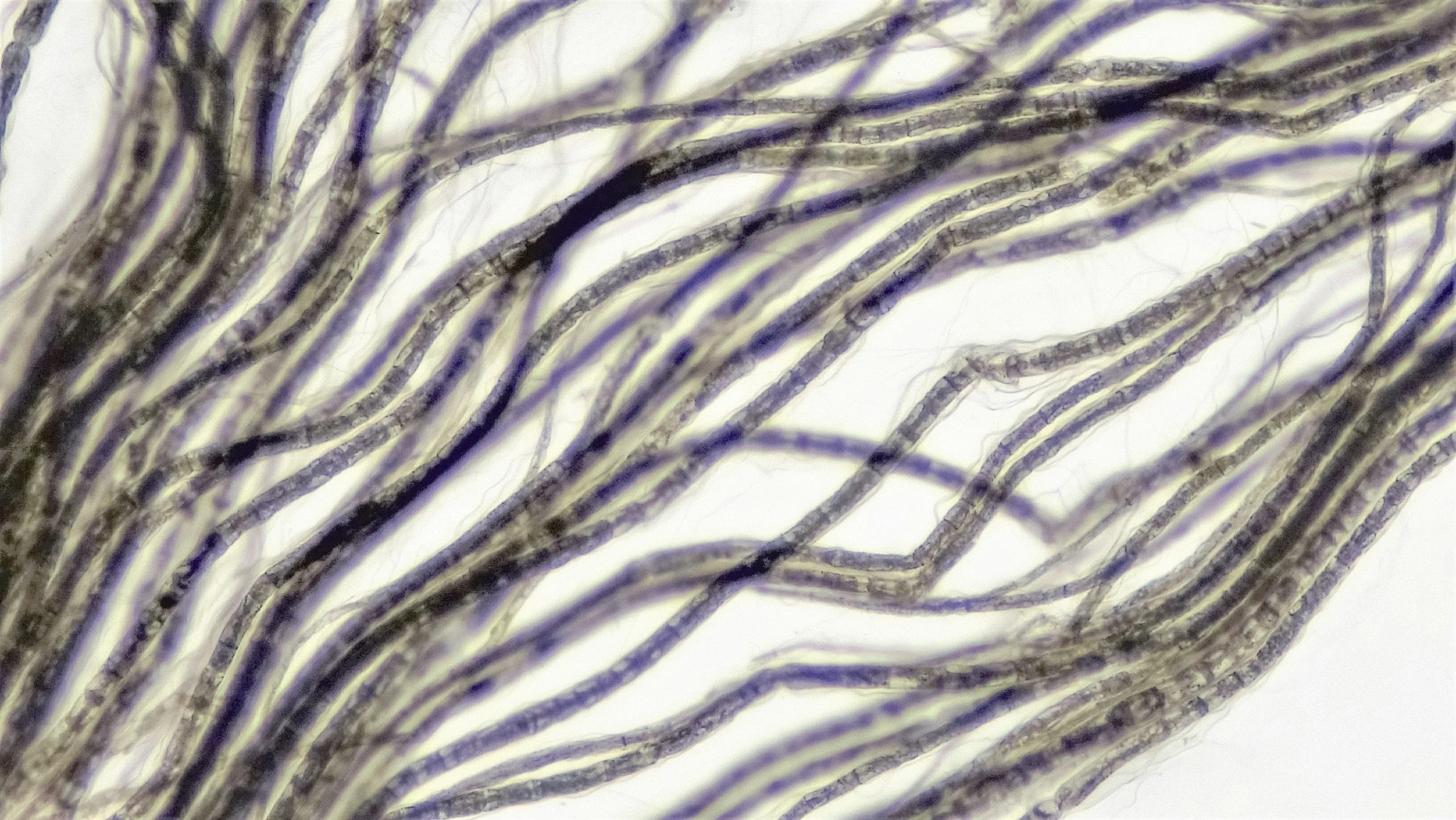 How Trauma Lives in the Body: Fascia, the Nervous System, + Practitioner Training in Toronto