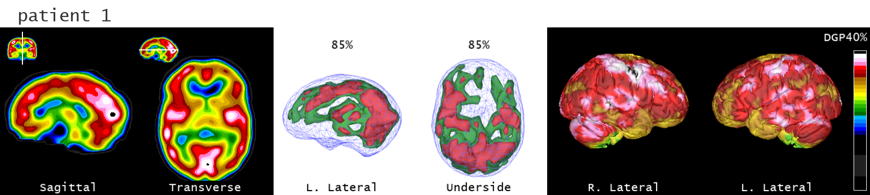 The Neuroscience Center | Explore effective mental health solutions now